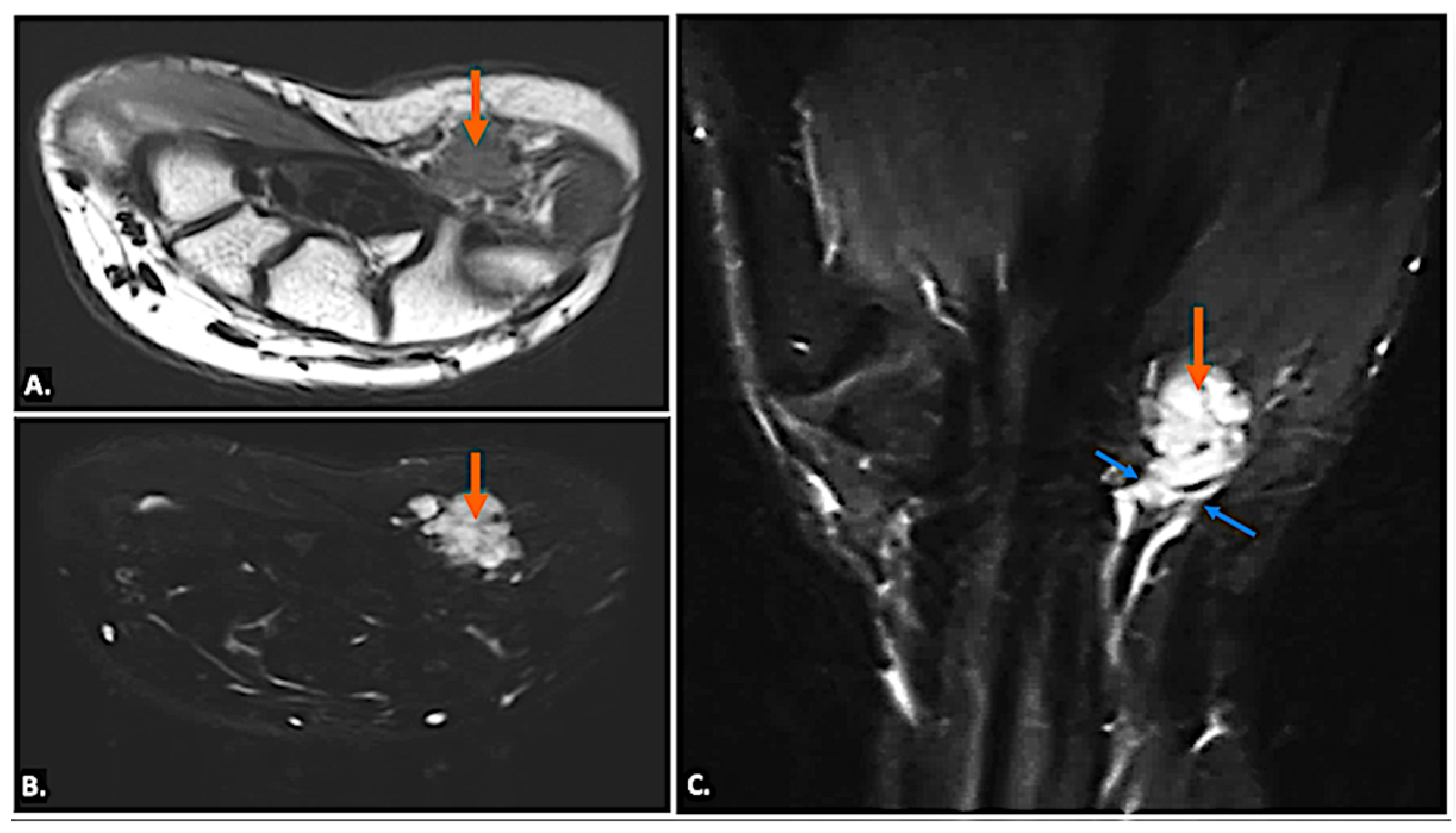 Diagnostics 15 00592 g015