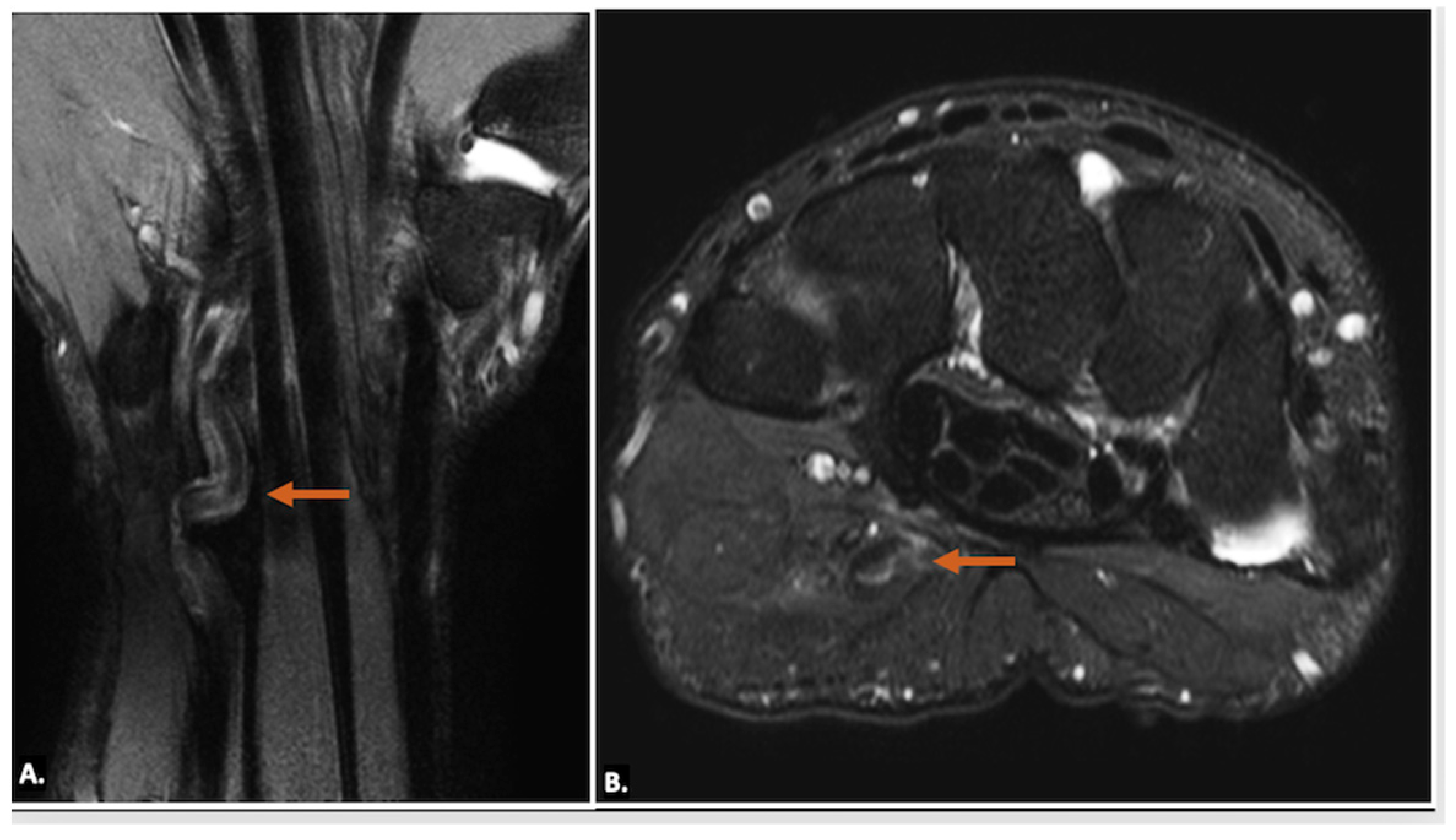 Diagnostics 15 00592 g016