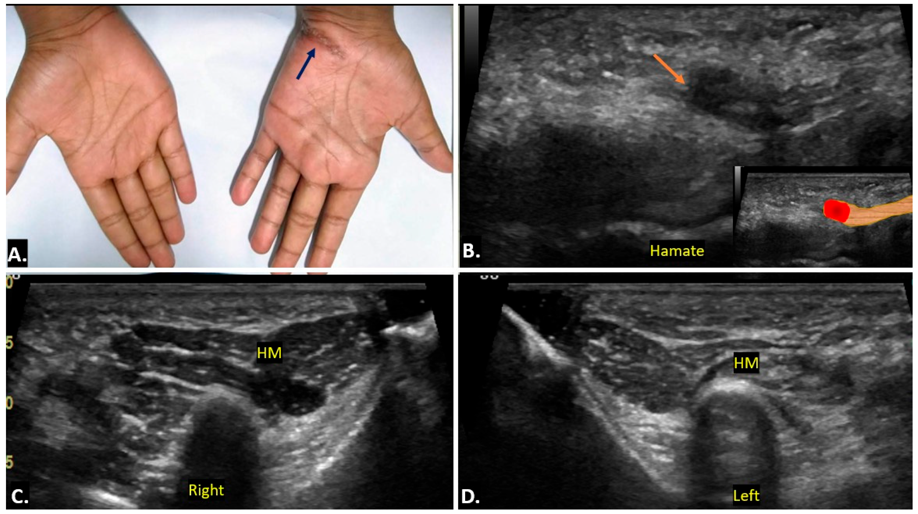 Diagnostics 15 00592 g017