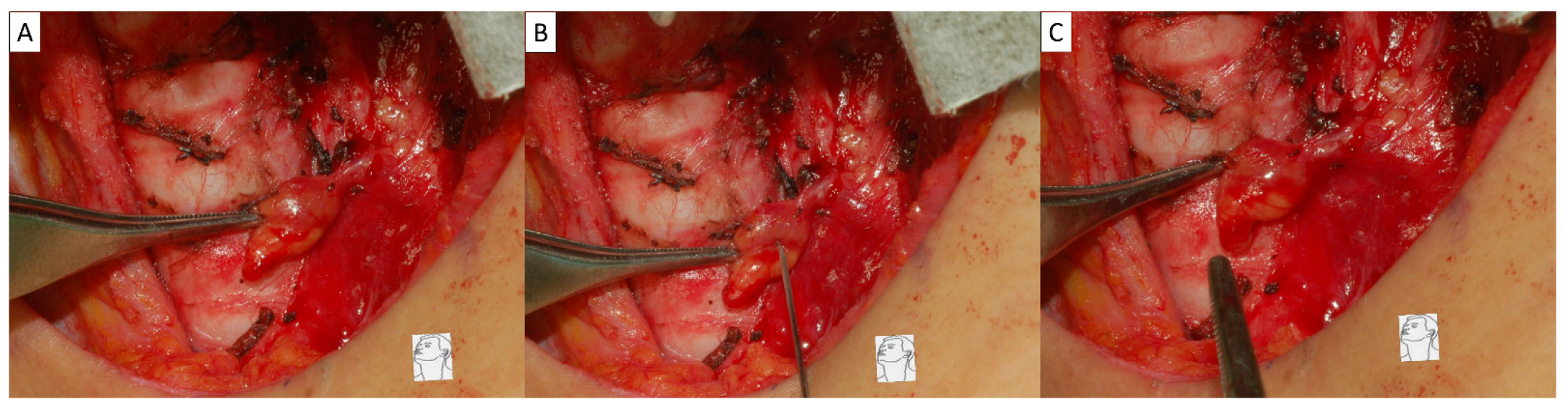 Diagnostics 15 00593 g001