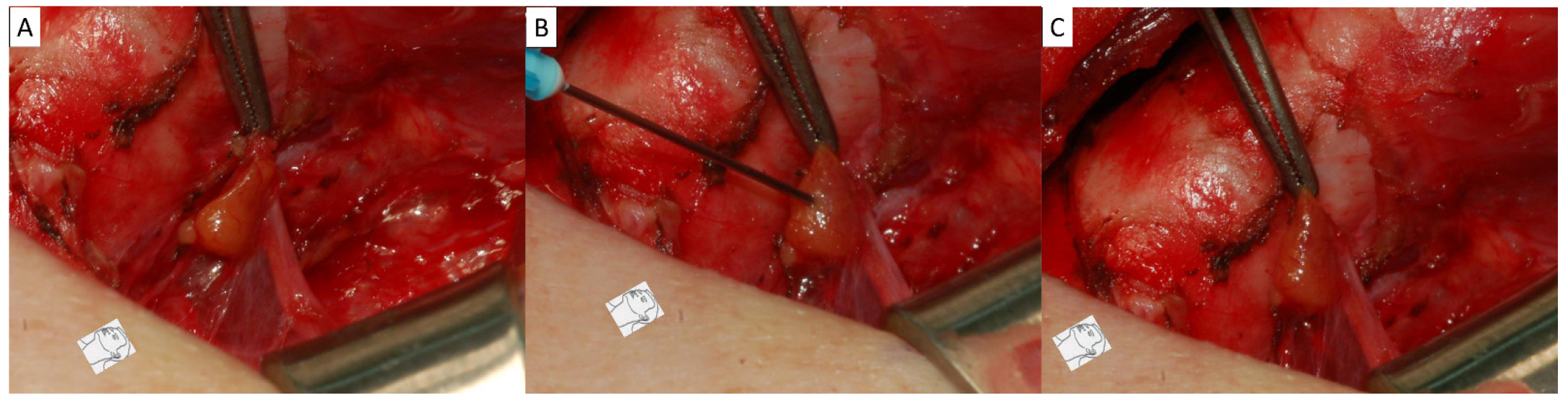 Diagnostics 15 00593 g002