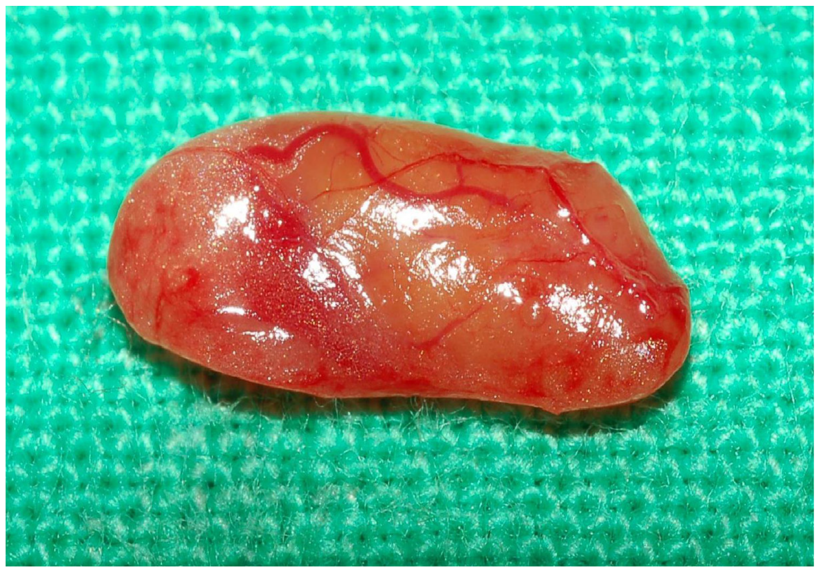 Diagnostics 15 00593 g003