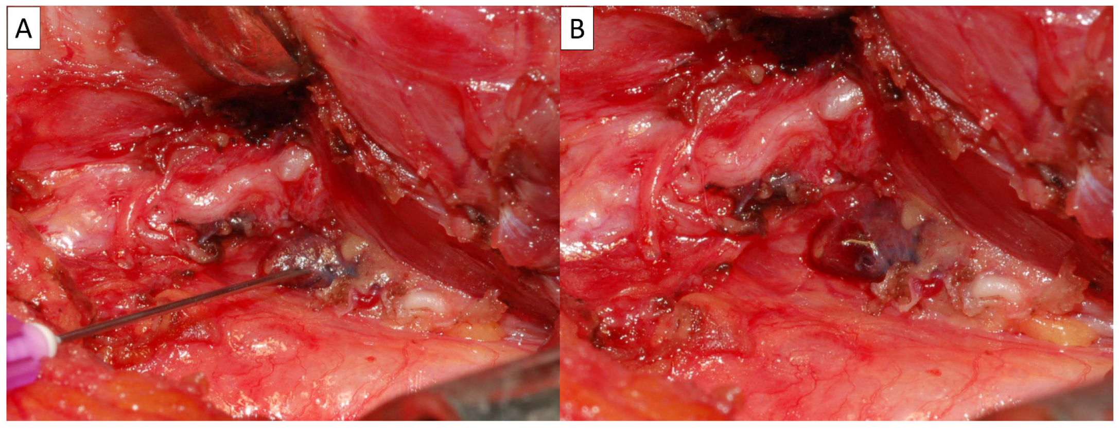 Diagnostics 15 00593 g004