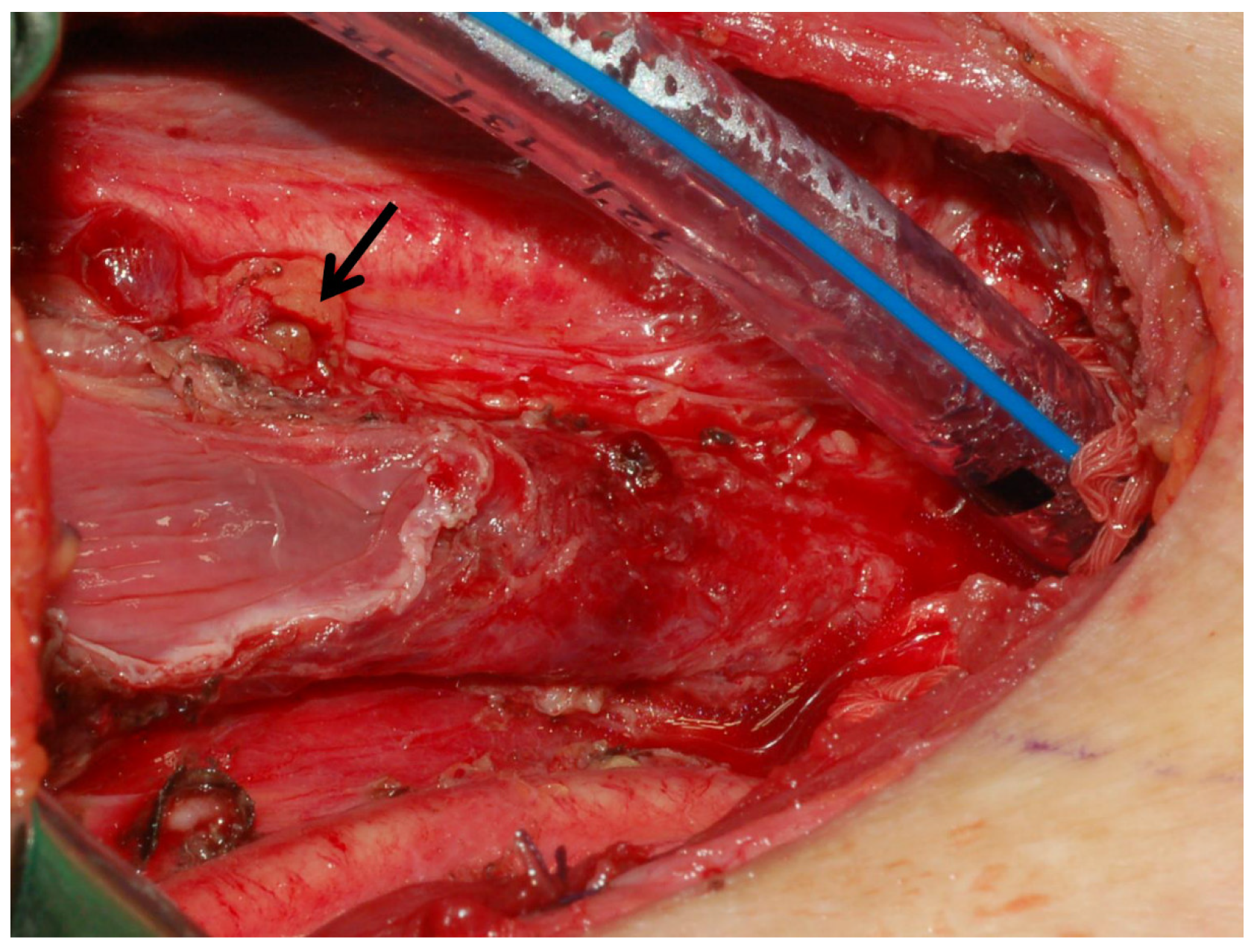 Diagnostics 15 00593 g005