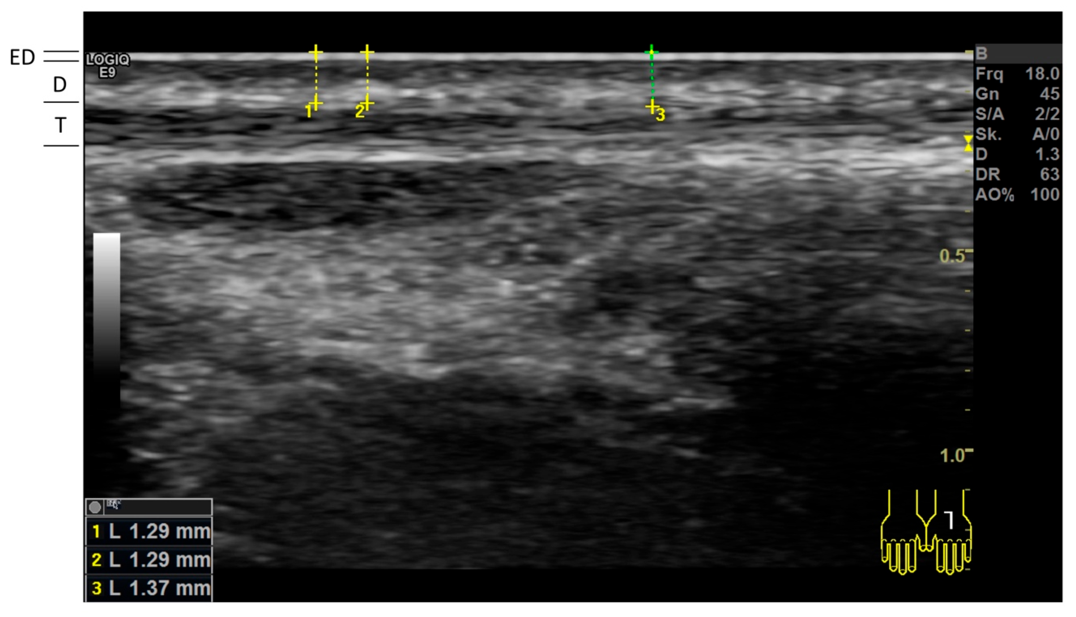 Diagnostics 15 00619 g001