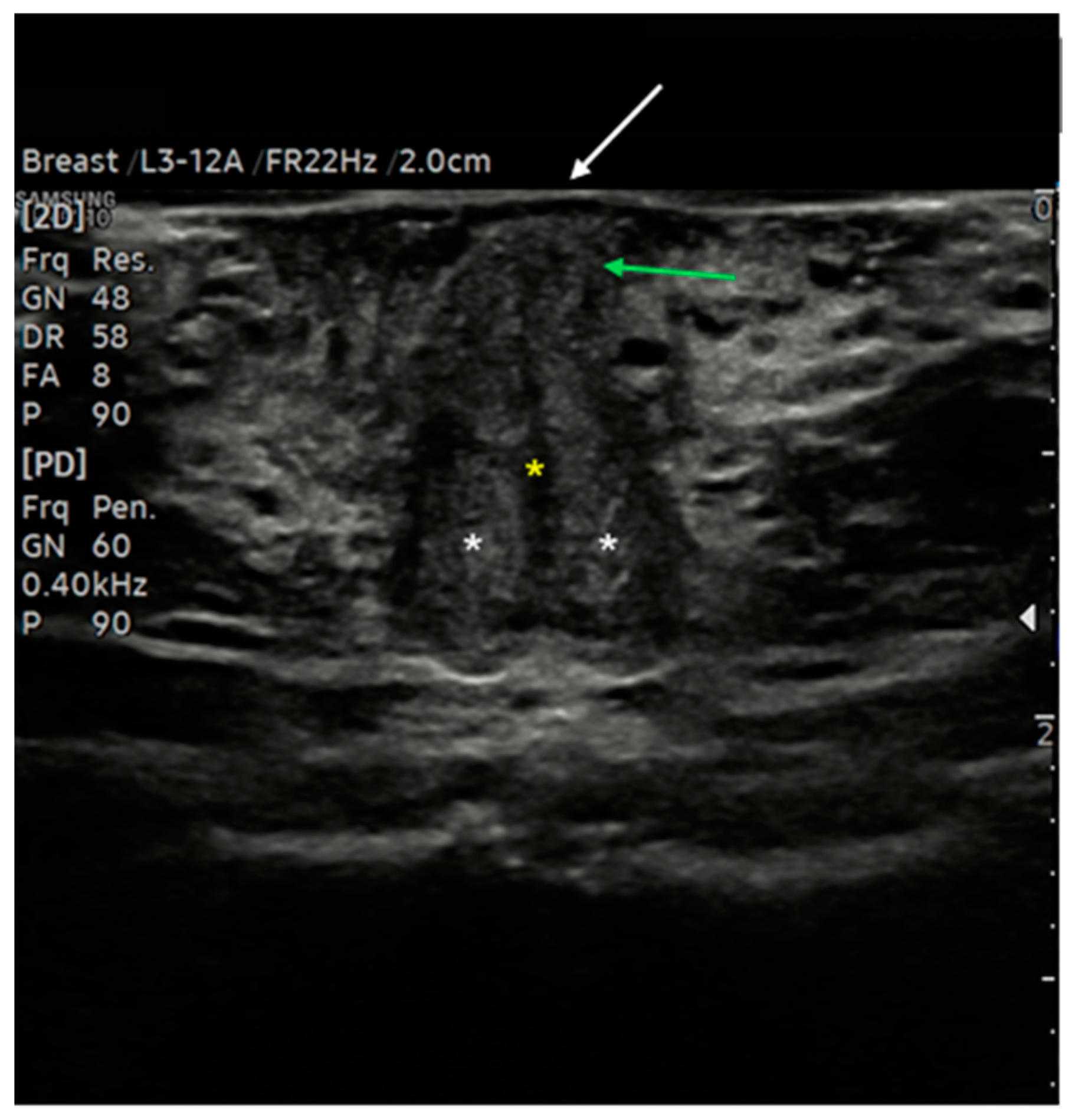 Diagnostics 15 00627 g006
