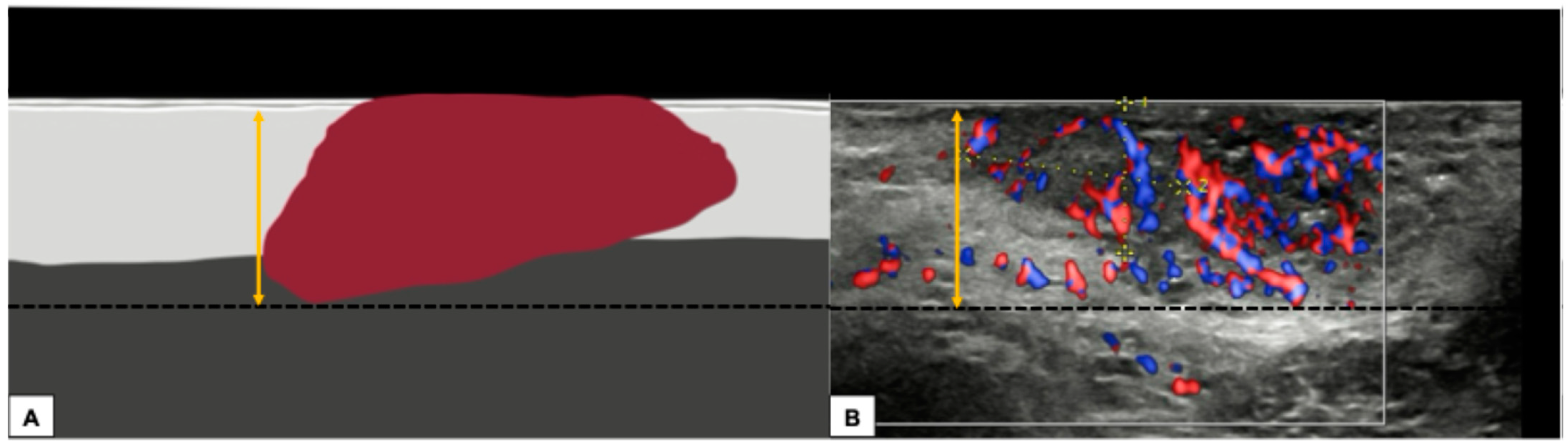 Diagnostics 15 00627 g010