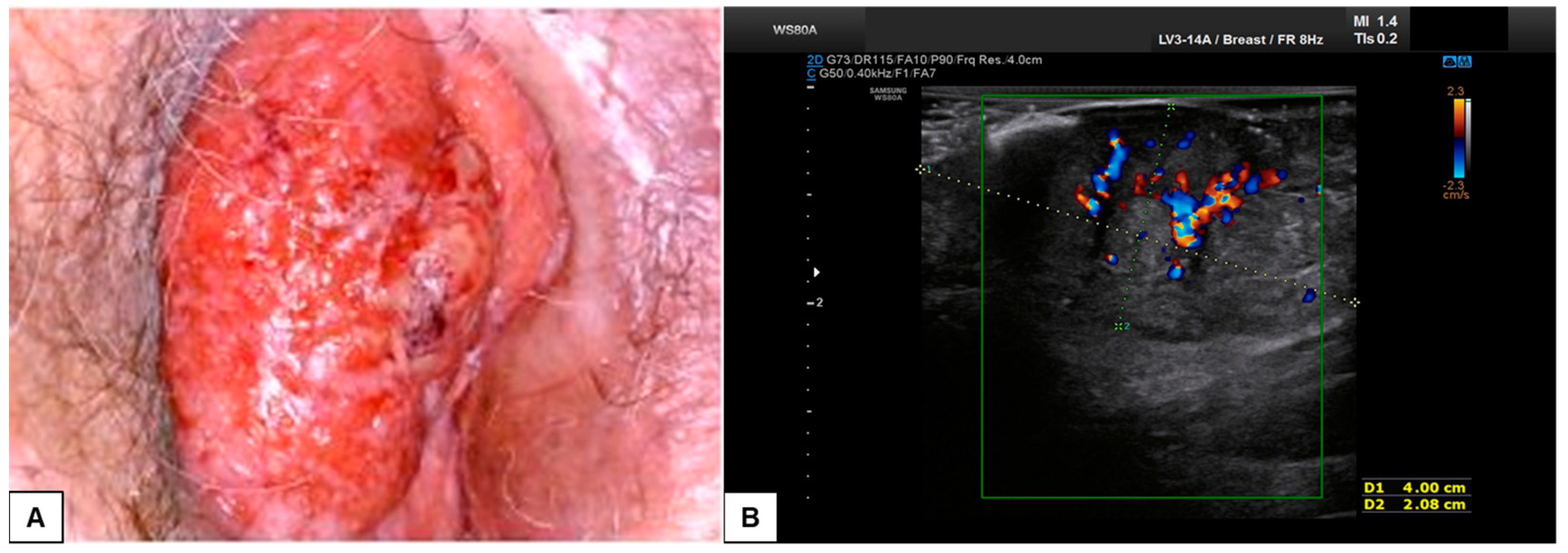 Diagnostics 15 00627 g011