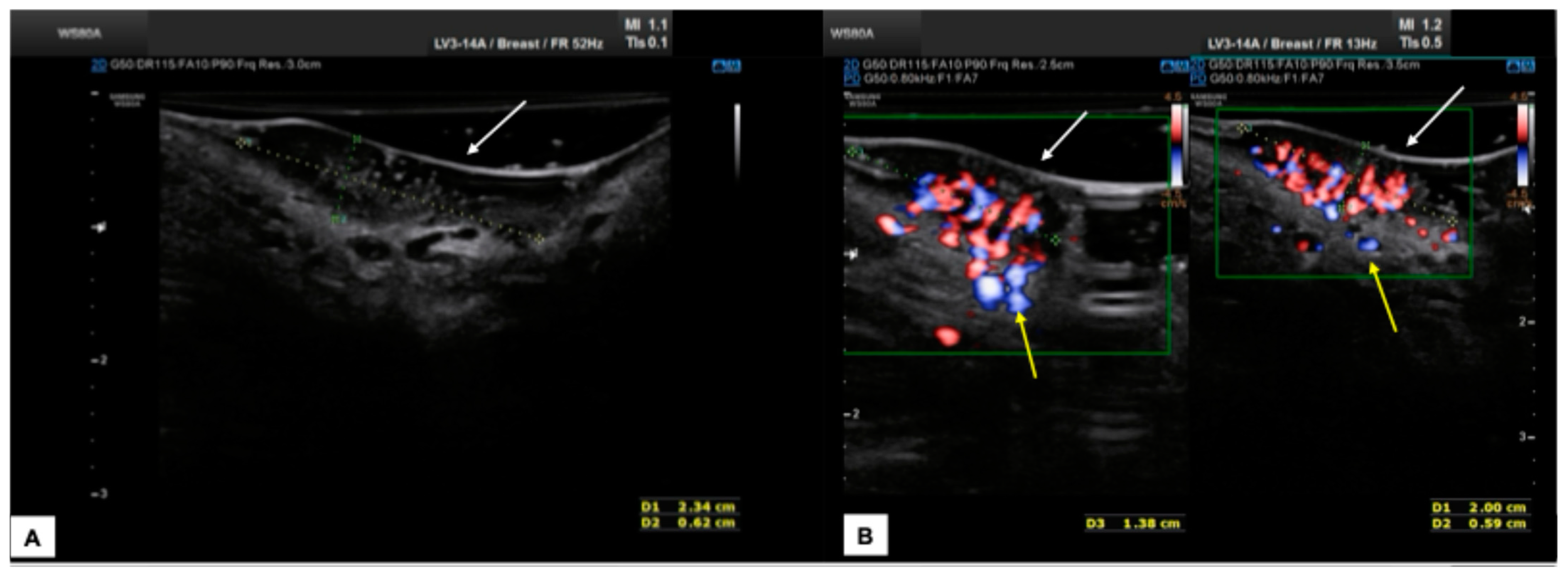 Diagnostics 15 00627 g013