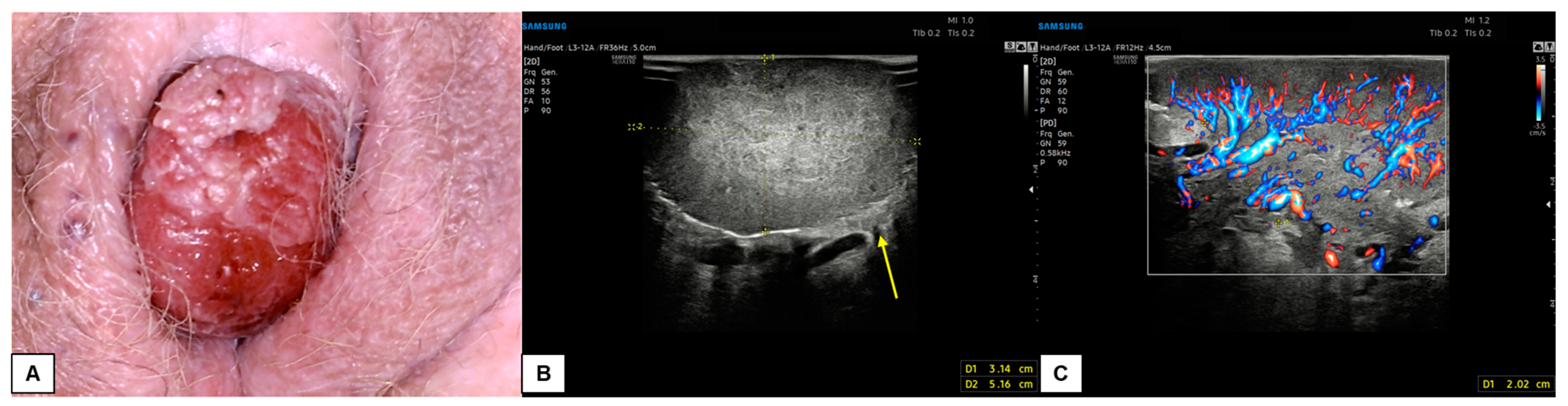 Diagnostics 15 00627 g014