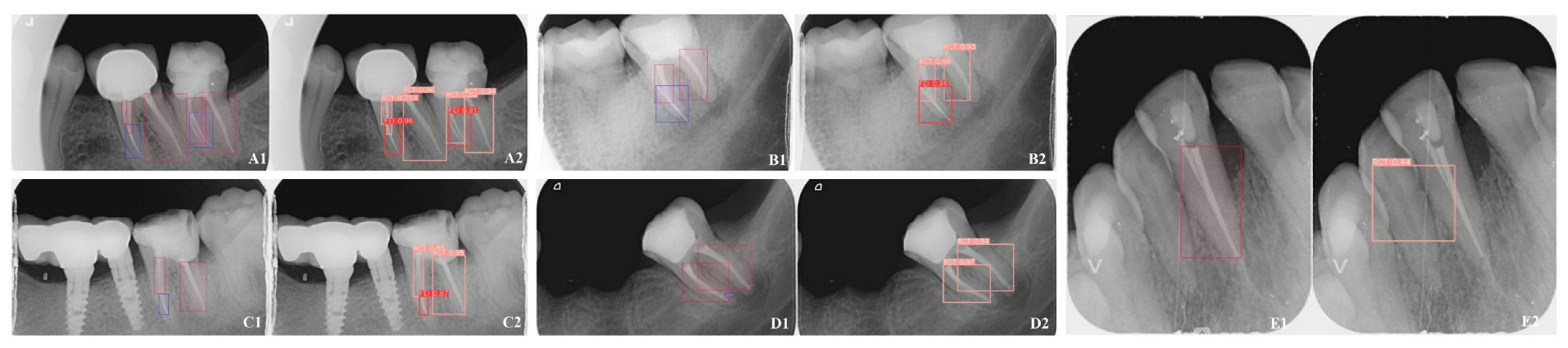 Diagnostics 15 00653 g001