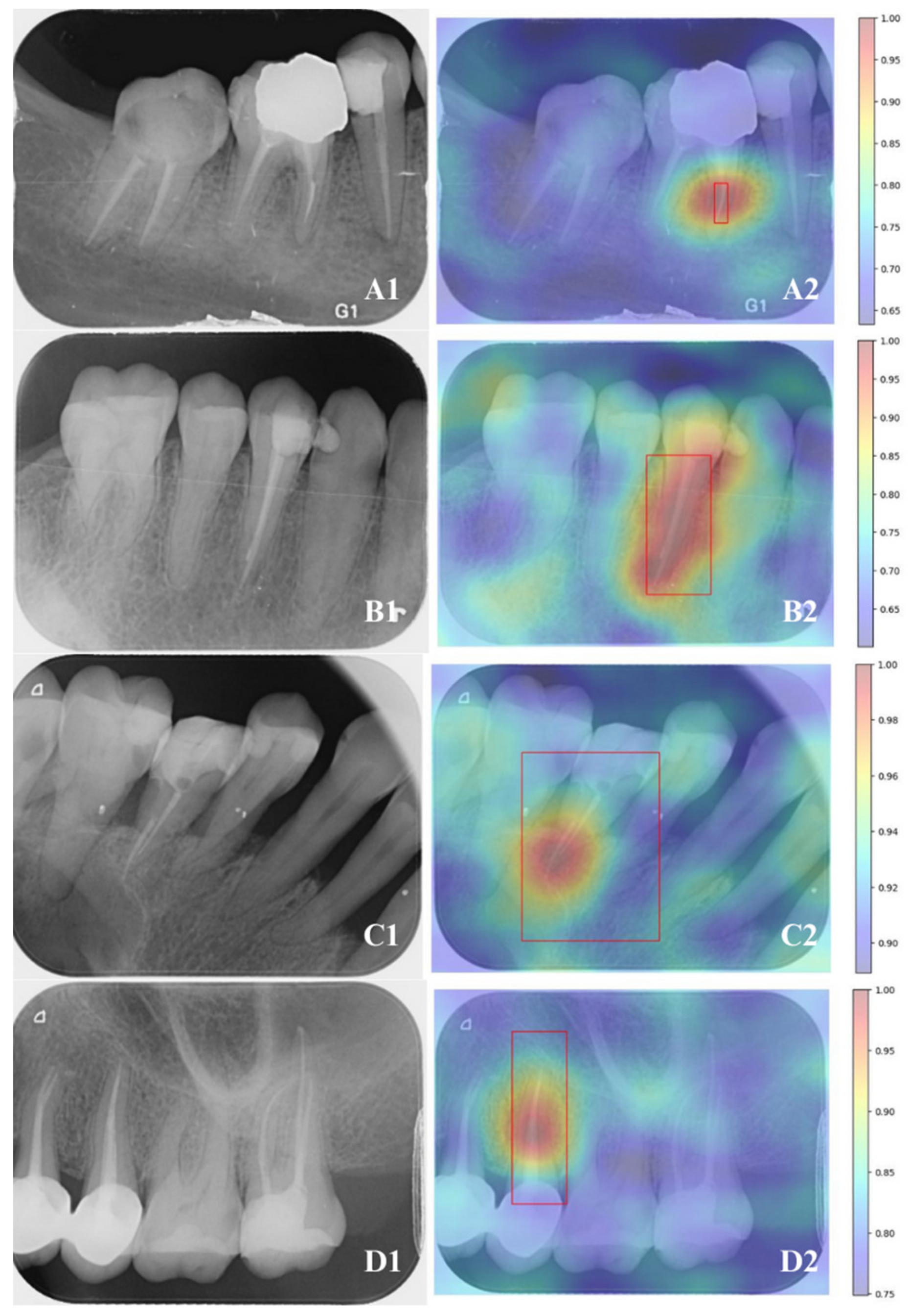 Diagnostics 15 00653 g004