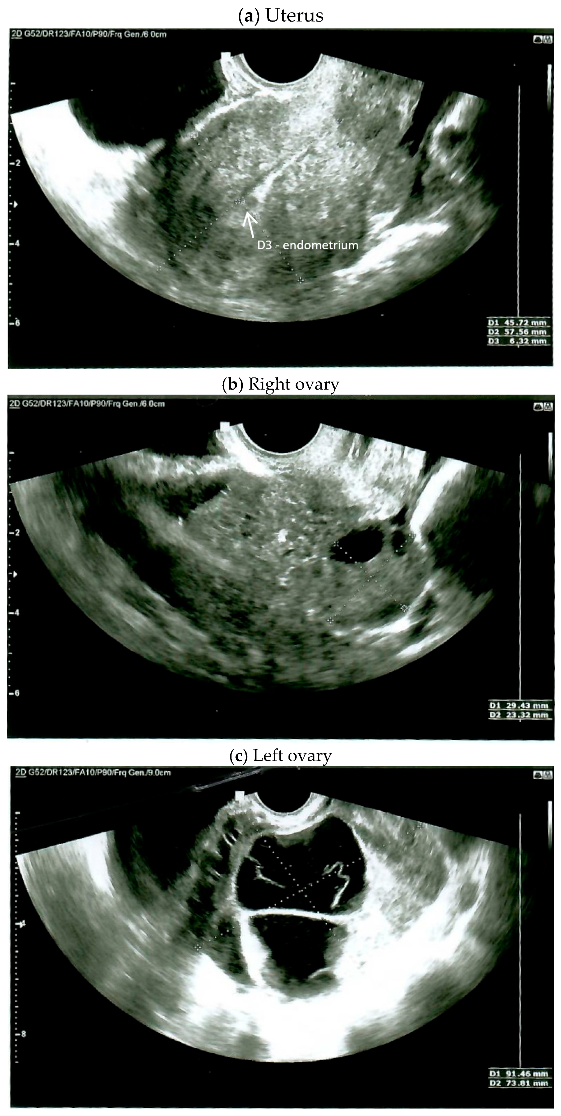 Diagnostics 15 00670 g001