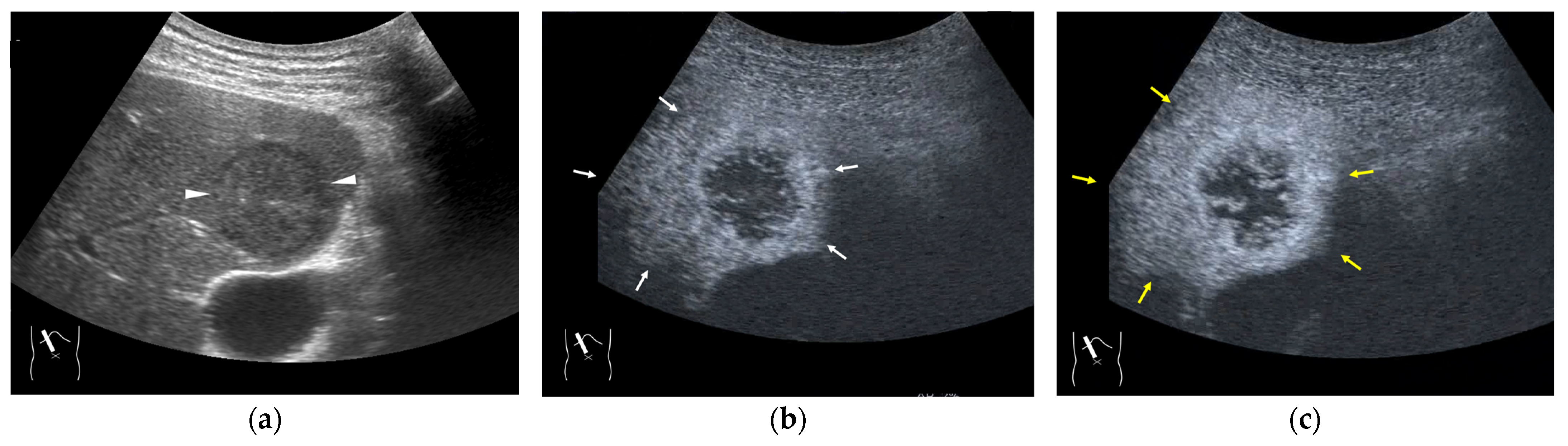 Diagnostics 15 00709 g005 Diagnostics 15 00709 g005