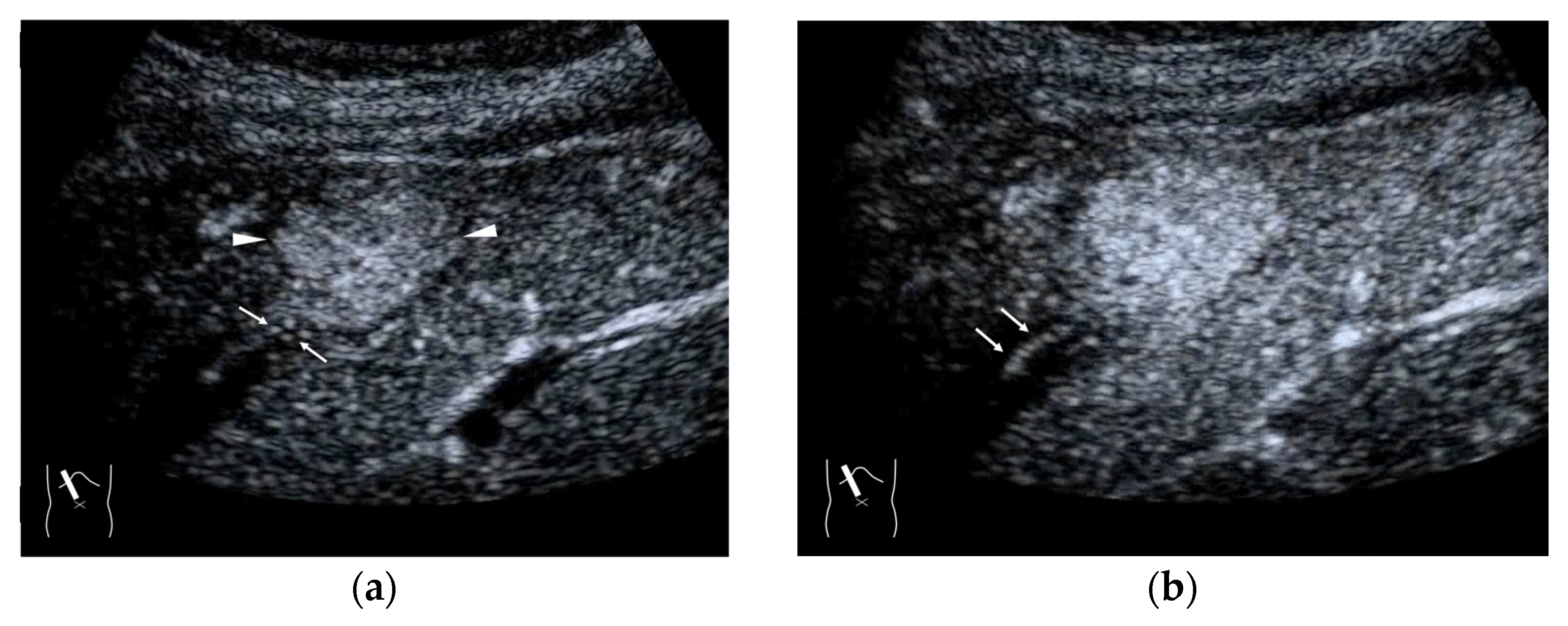 Diagnostics 15 00709 g006 Diagnostics 15 00709 g006