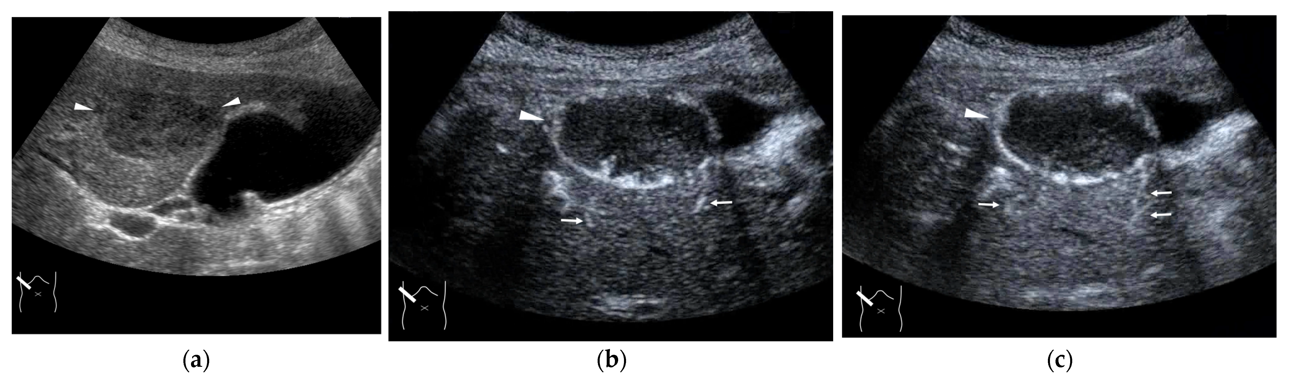 Diagnostics 15 00709 g007 Diagnostics 15 00709 g007
