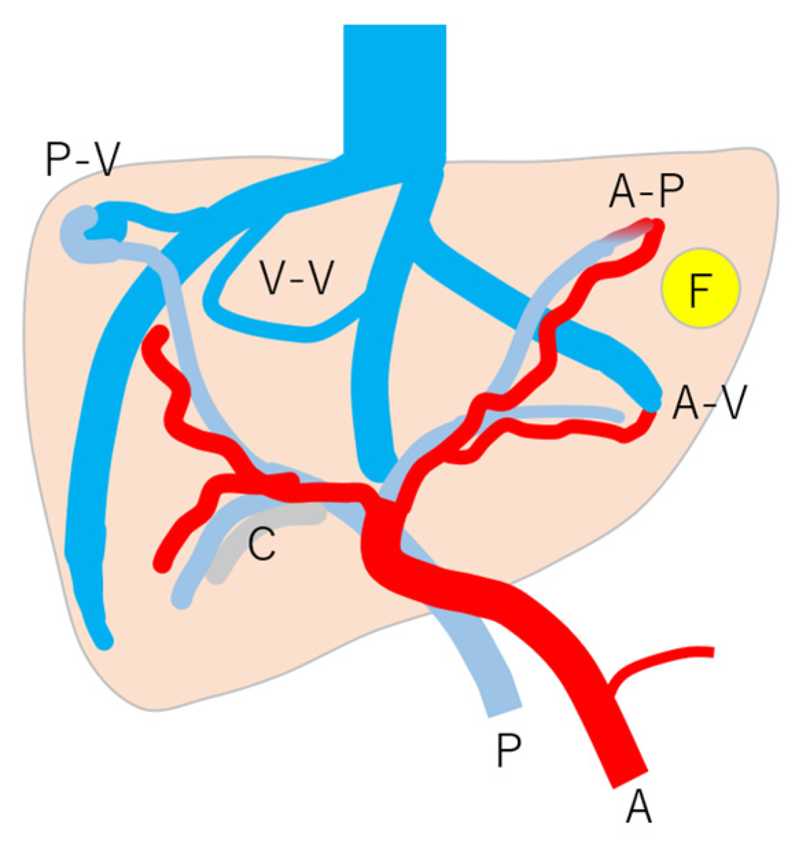 Diagnostics 15 00709 g008 Diagnostics 15 00709 g008