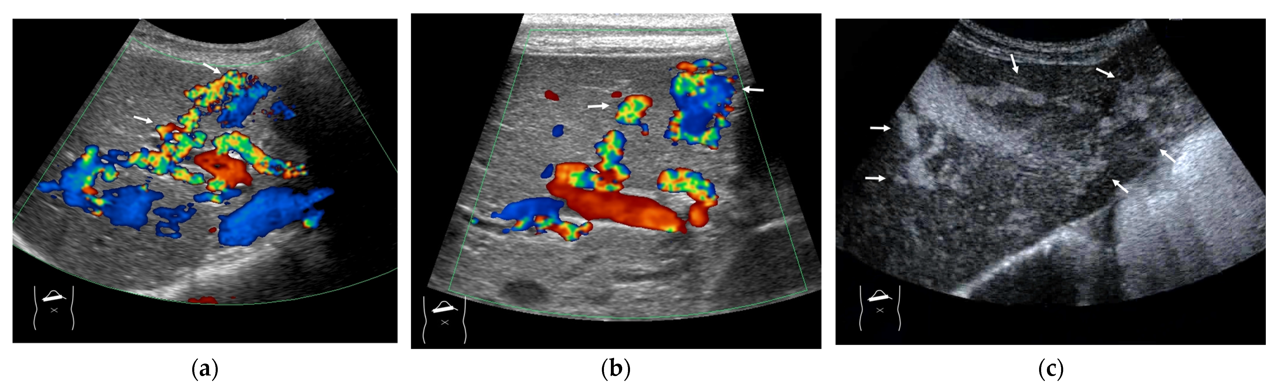 Diagnostics 15 00709 g009 Diagnostics 15 00709 g009