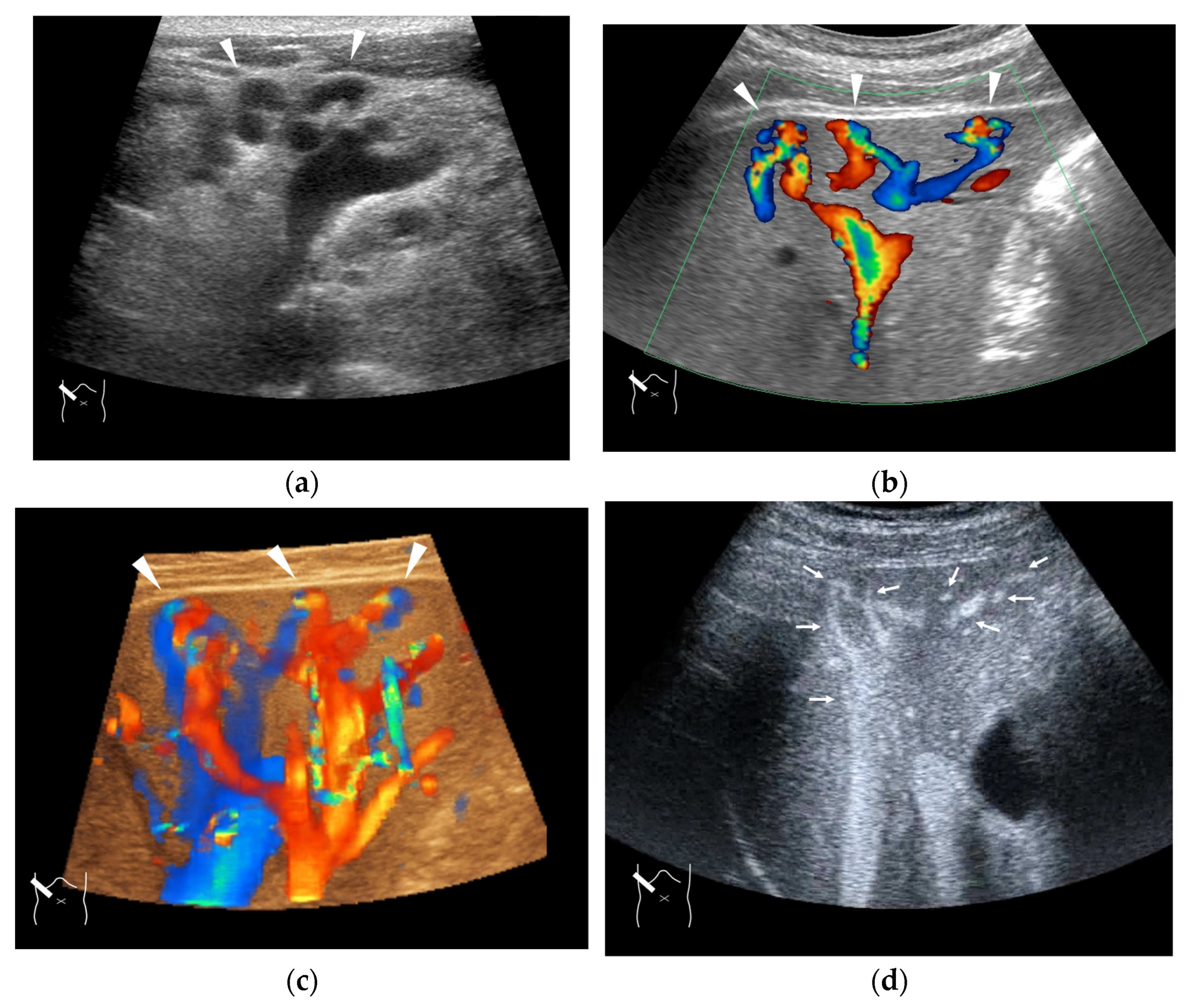Diagnostics 15 00709 g011 Diagnostics 15 00709 g011