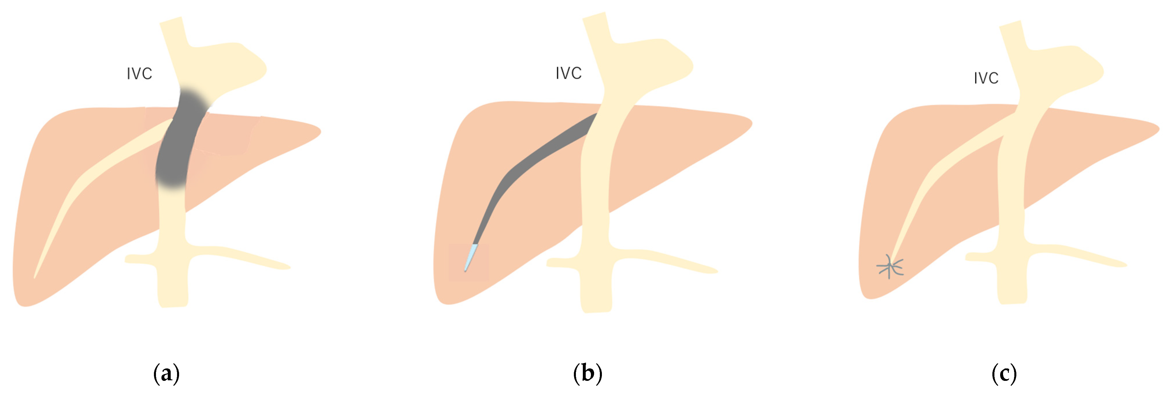 Diagnostics 15 00709 g012 Diagnostics 15 00709 g012