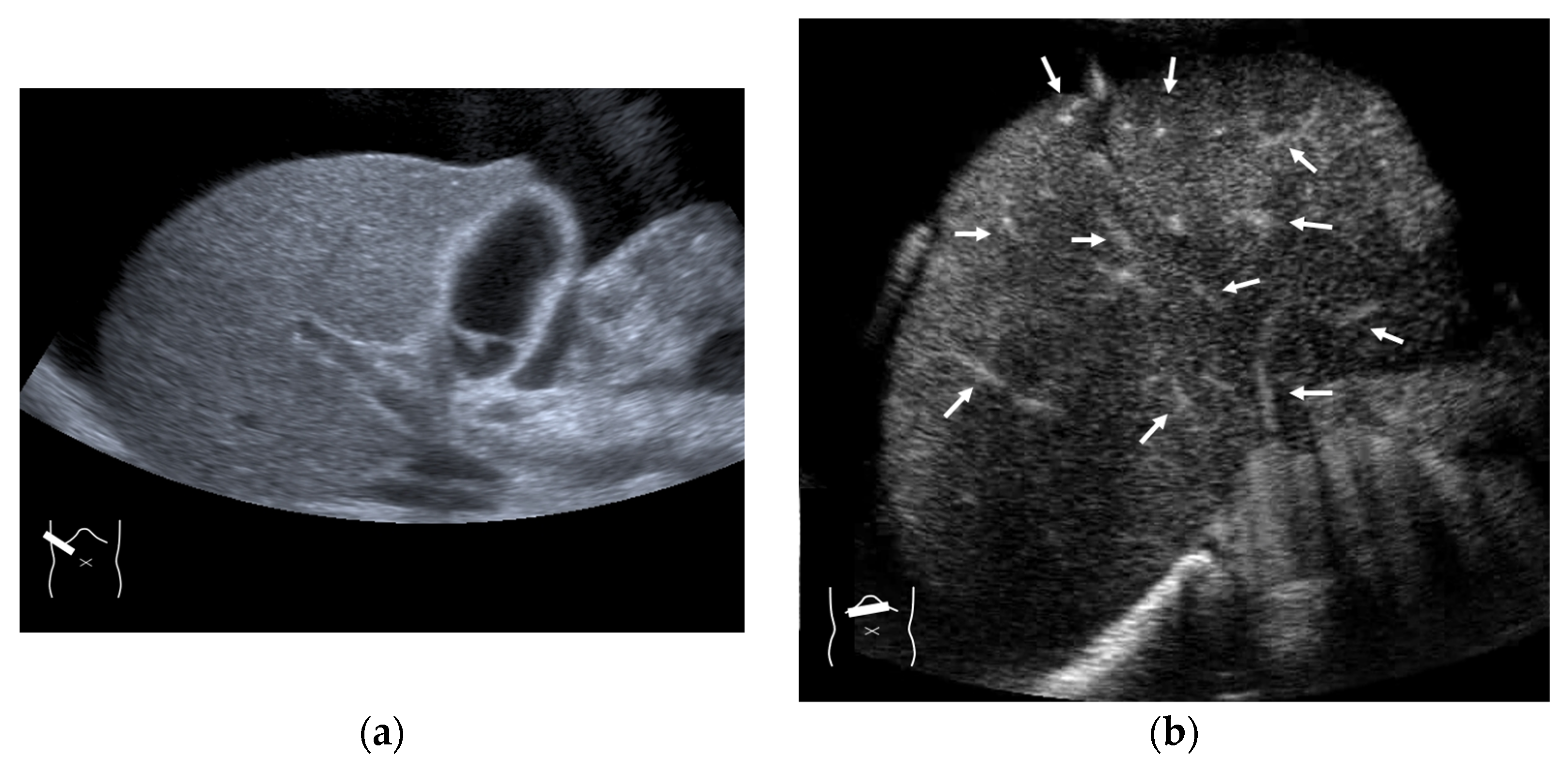 Diagnostics 15 00709 g014 Diagnostics 15 00709 g014