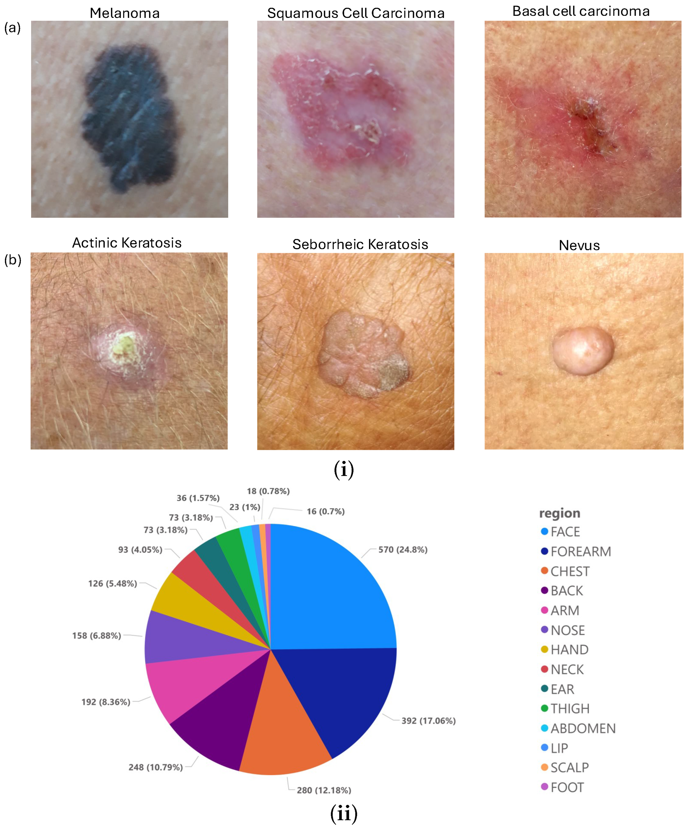 Diagnostics 15 00710 g001 Diagnostics 15 00710 g001