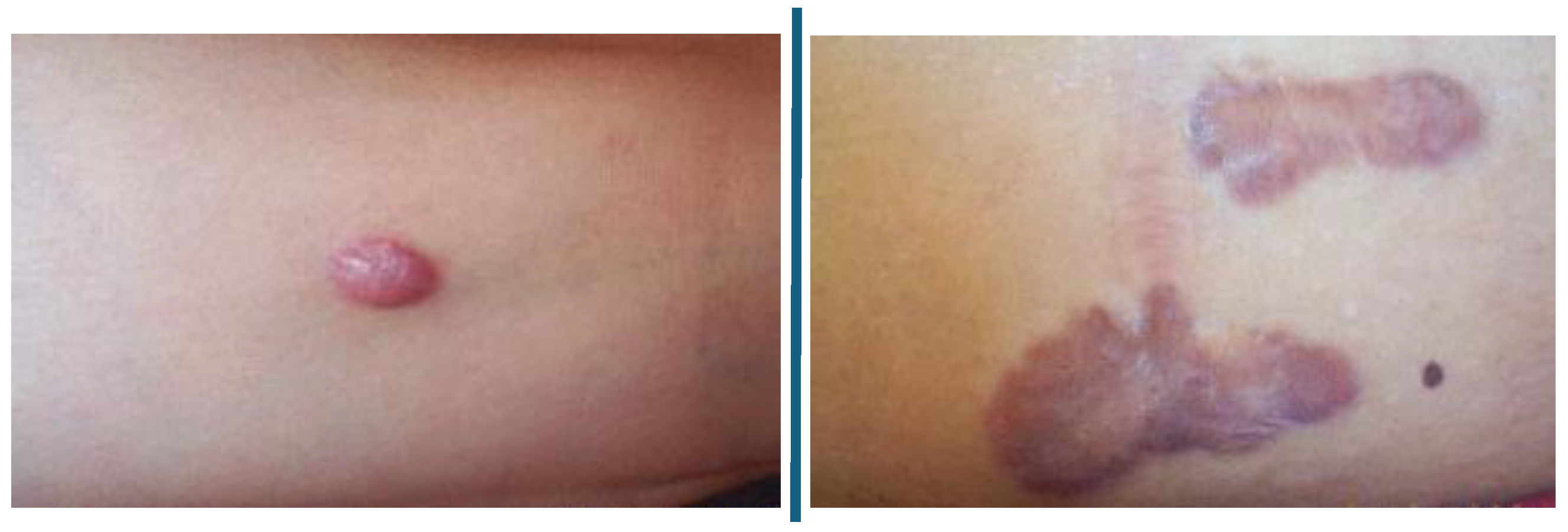 Diagnostics 15 00710 g002 Diagnostics 15 00710 g002