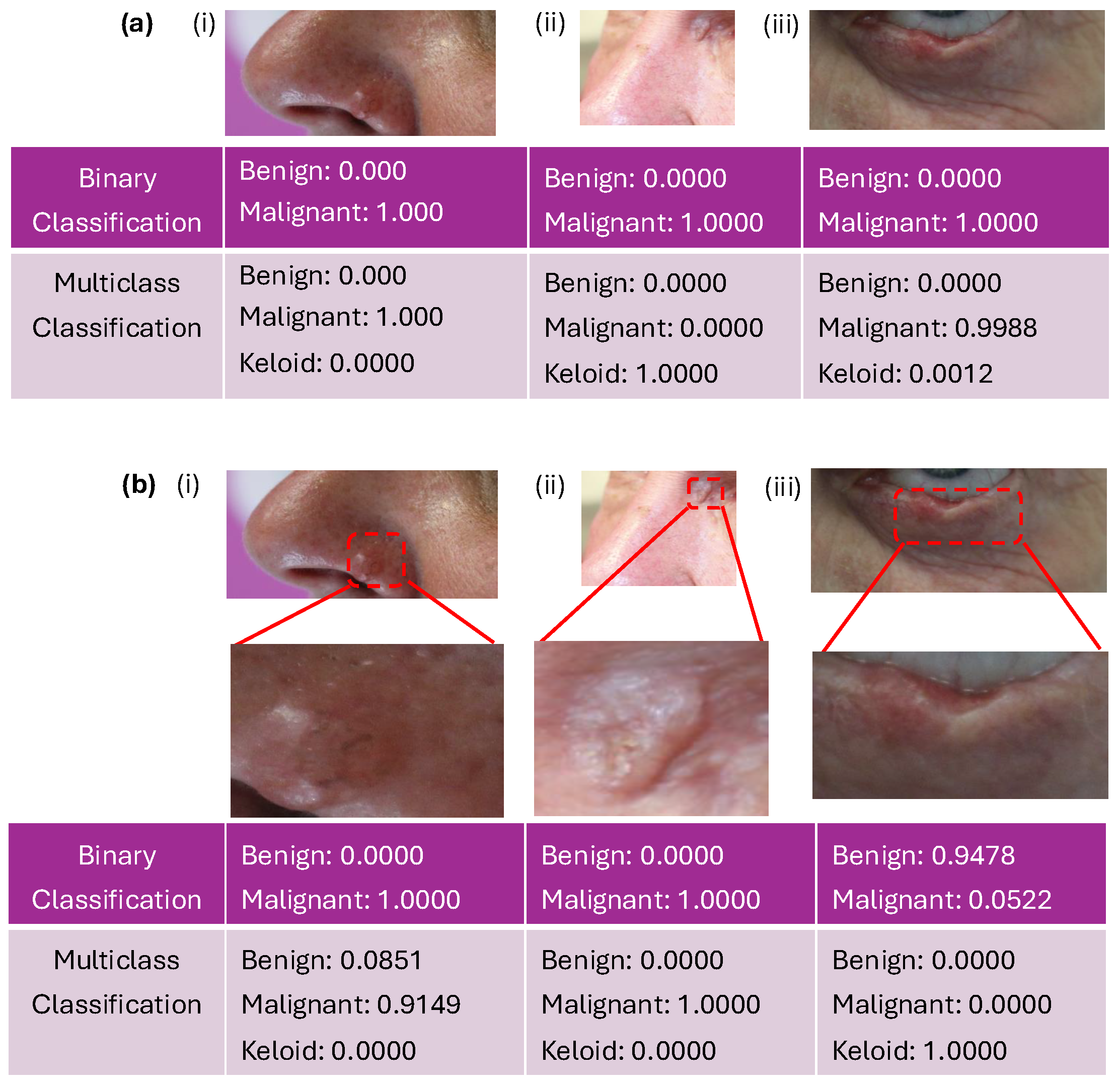 Diagnostics 15 00710 g009 Diagnostics 15 00710 g009
