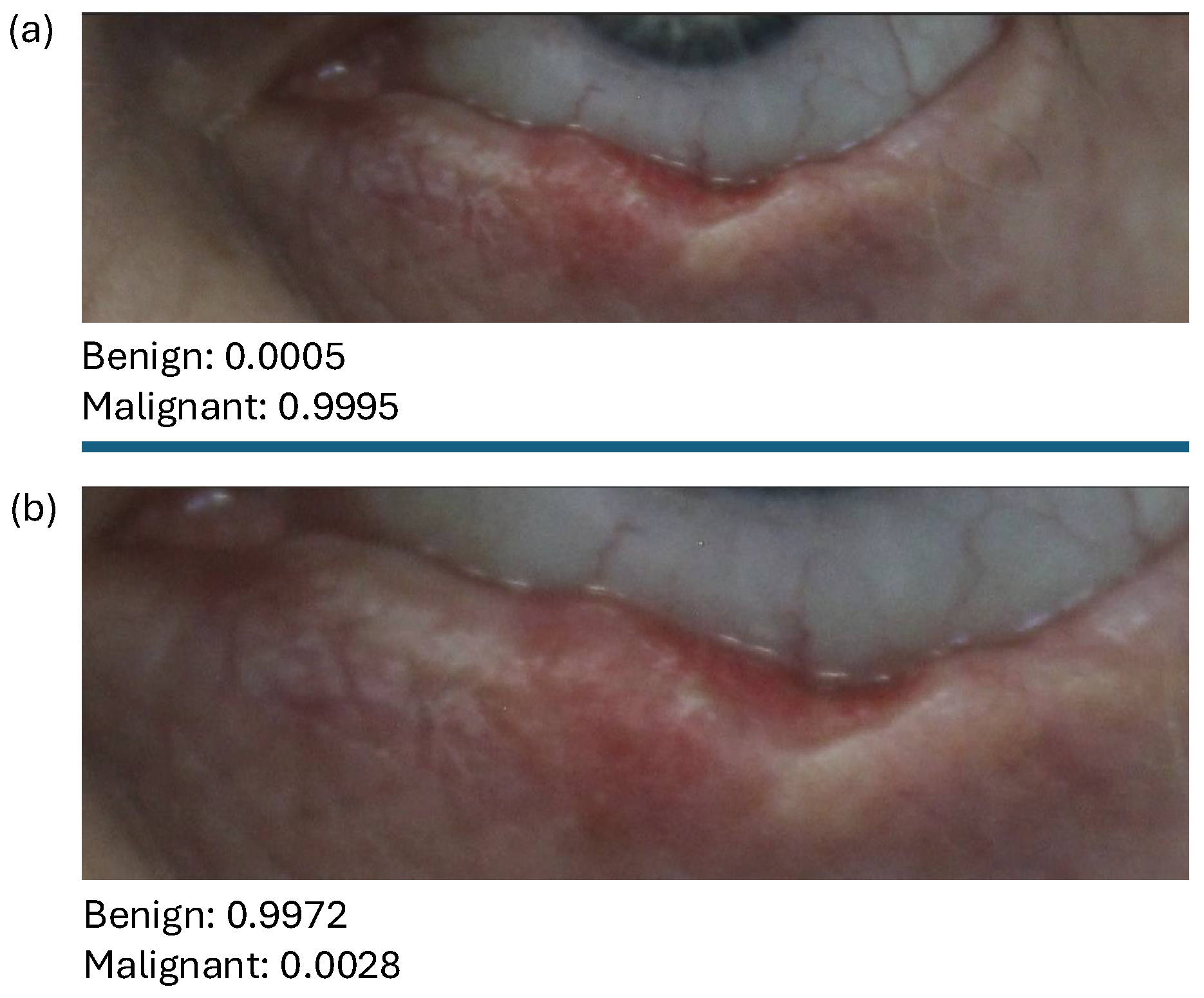 Diagnostics 15 00710 g010 Diagnostics 15 00710 g010