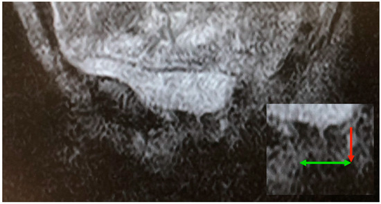 Diagnostics 15 00723 g008