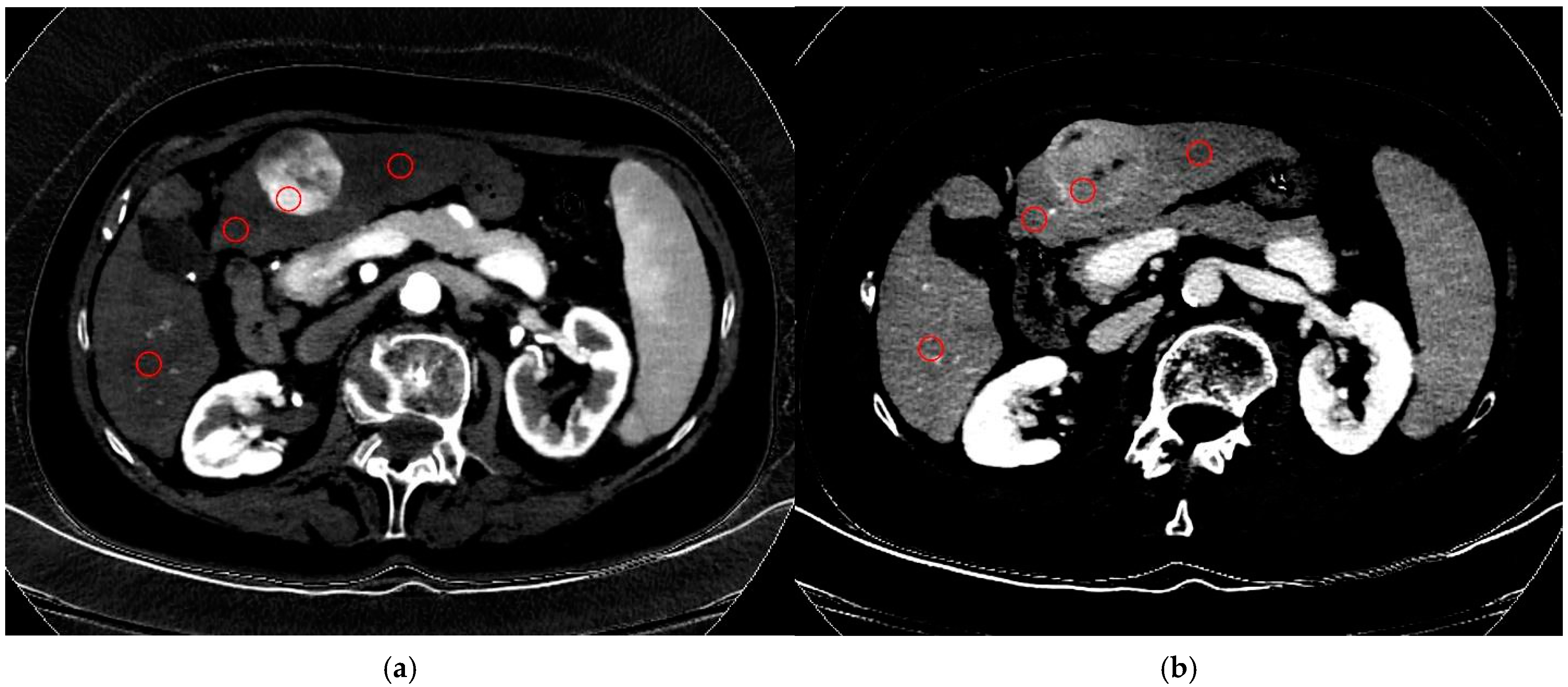 Diagnostics 15 00725 g002