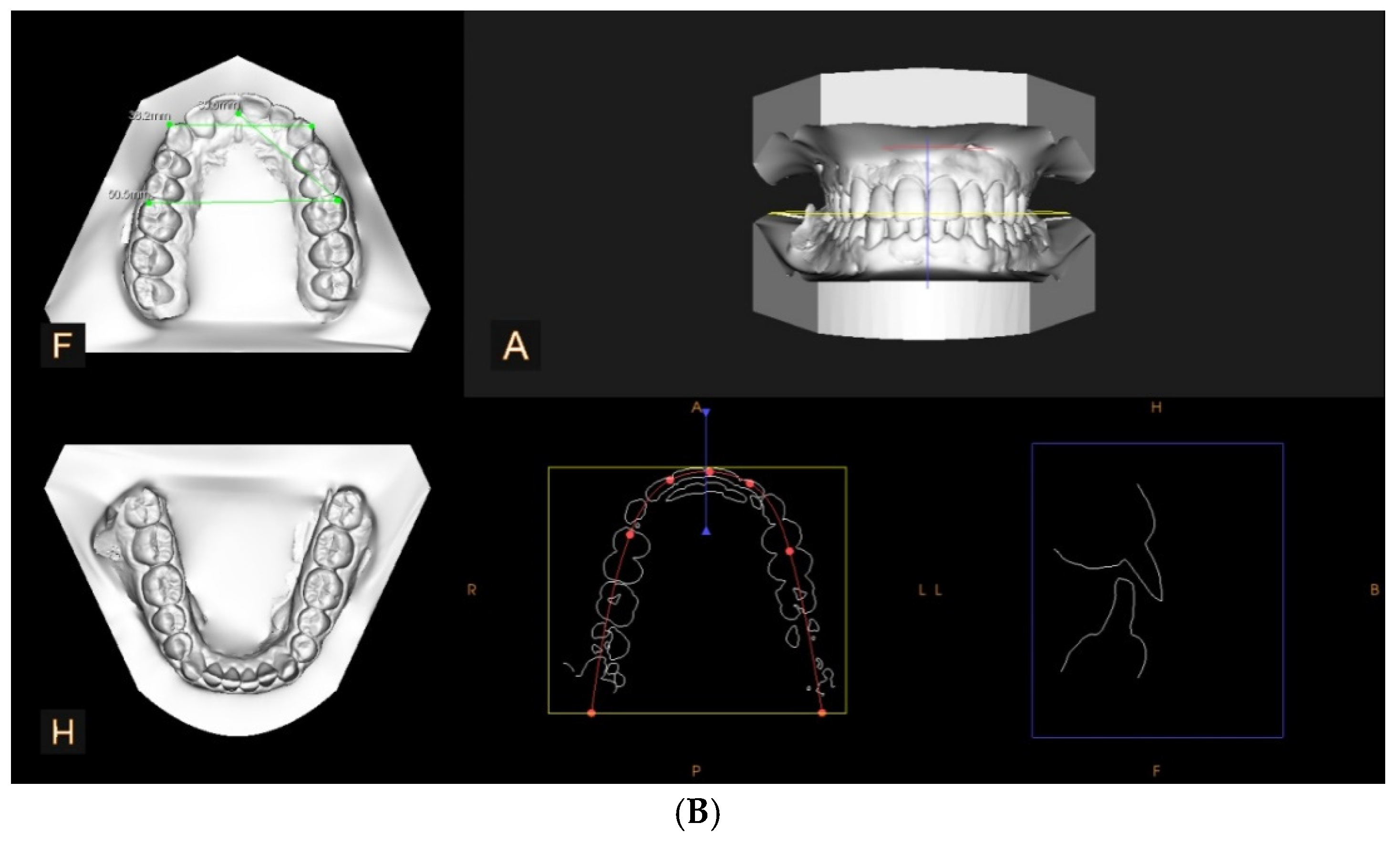 Diagnostics 15 00738 g001b