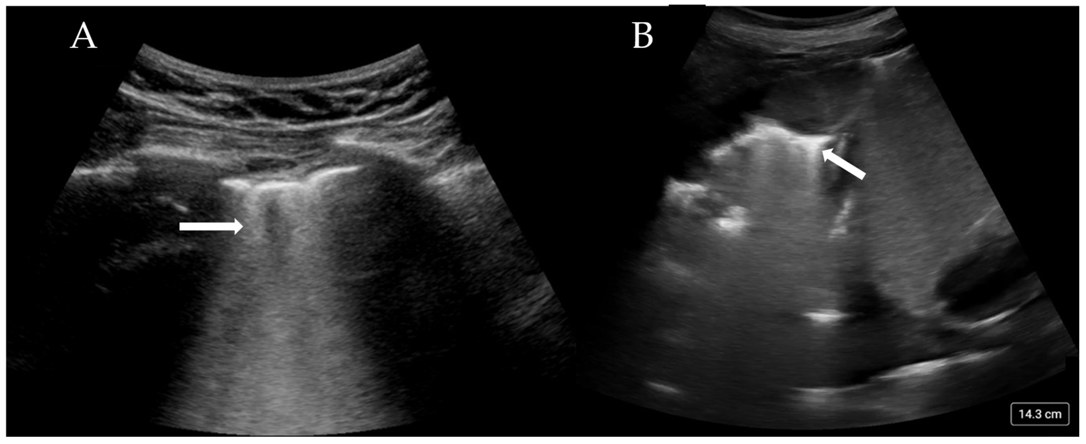 Diagnostics 15 00755 g002 Diagnostics 15 00755 g002