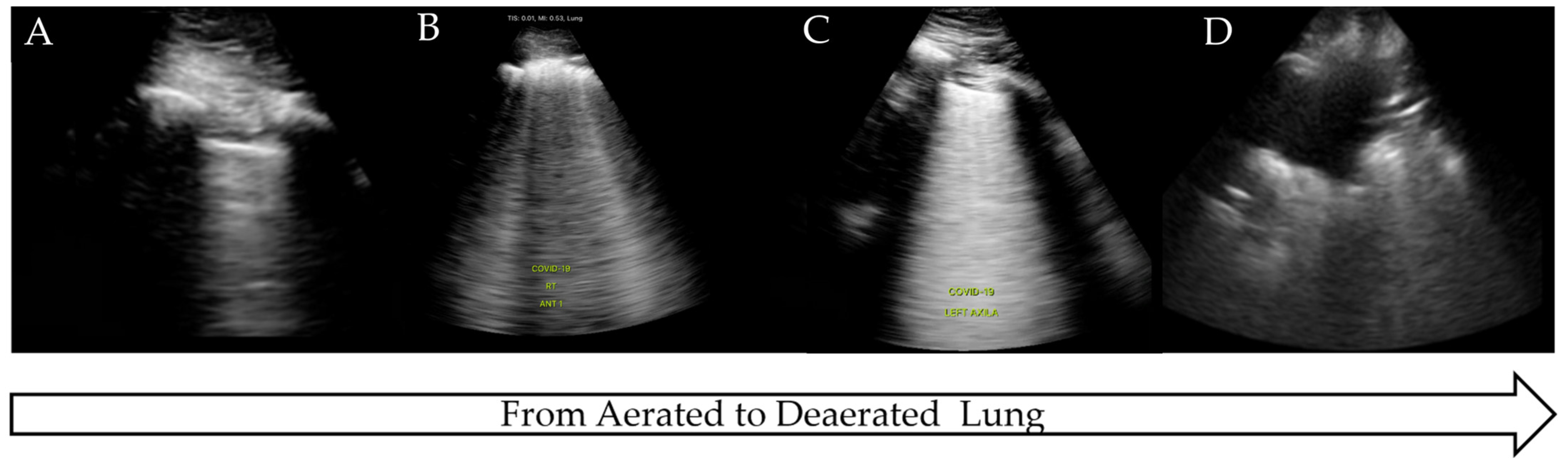 Diagnostics 15 00755 g004 Diagnostics 15 00755 g004