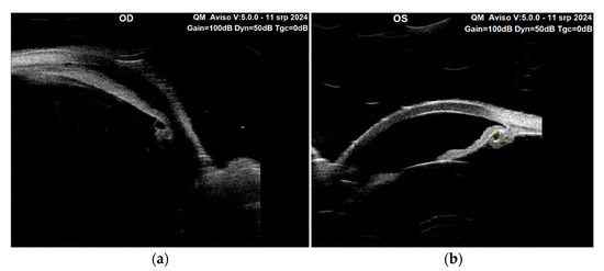 Diagnostics 15 00758 g004