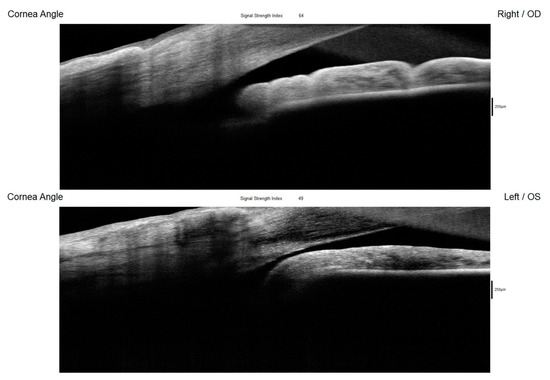 Diagnostics 15 00758 g005