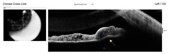 Diagnostics 15 00758 g006