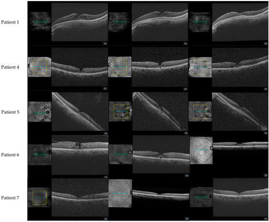 Diagnostics 15 00759 g0a1