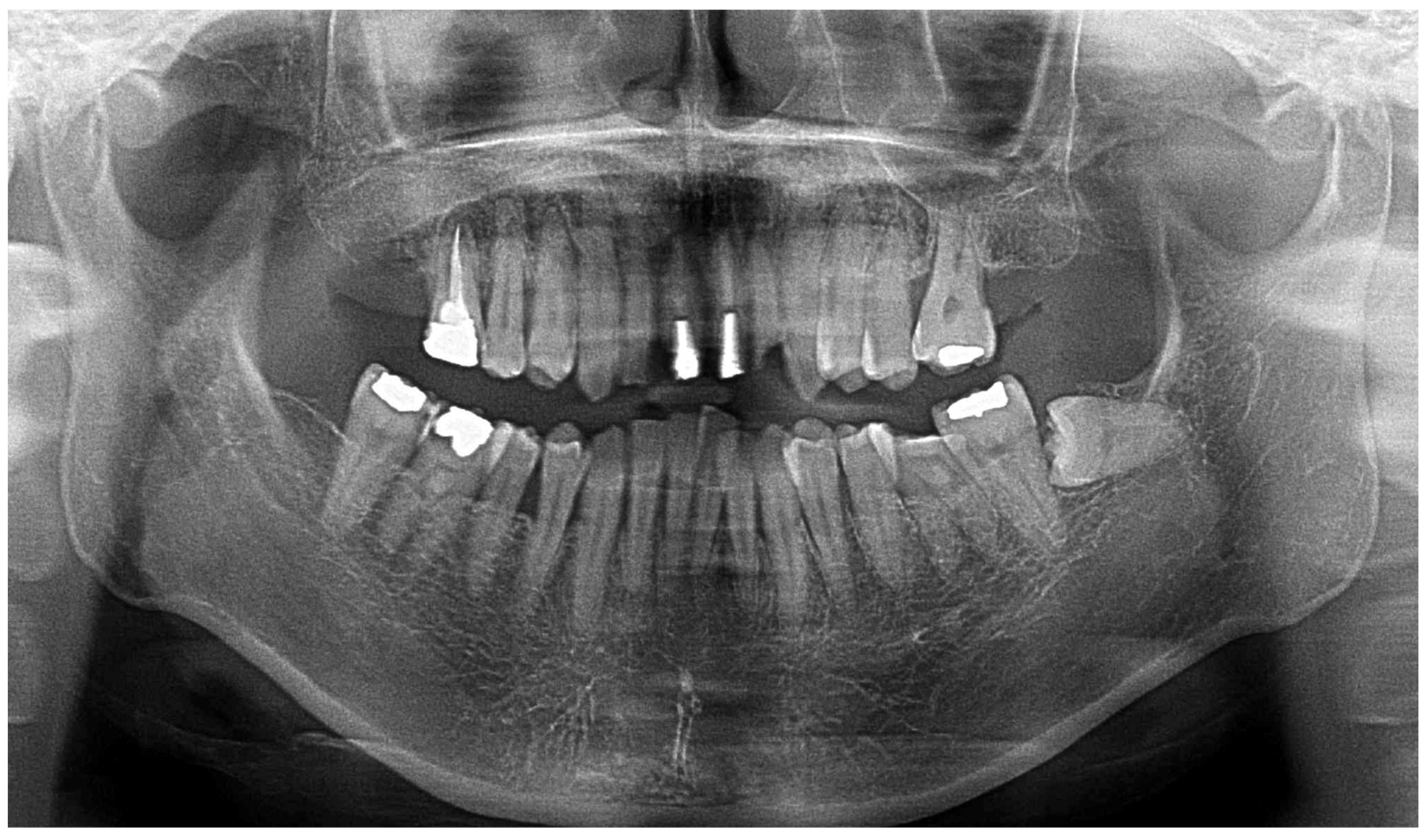 Diagnostics 15 00765 g002 Diagnostics 15 00765 g002