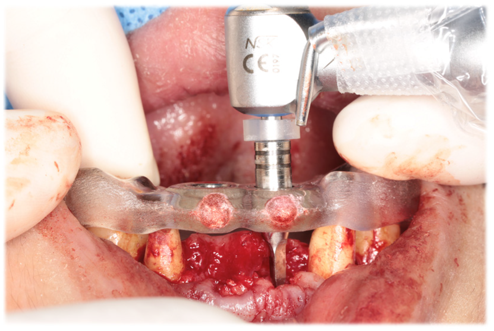 Diagnostics 15 00765 g006 Diagnostics 15 00765 g006