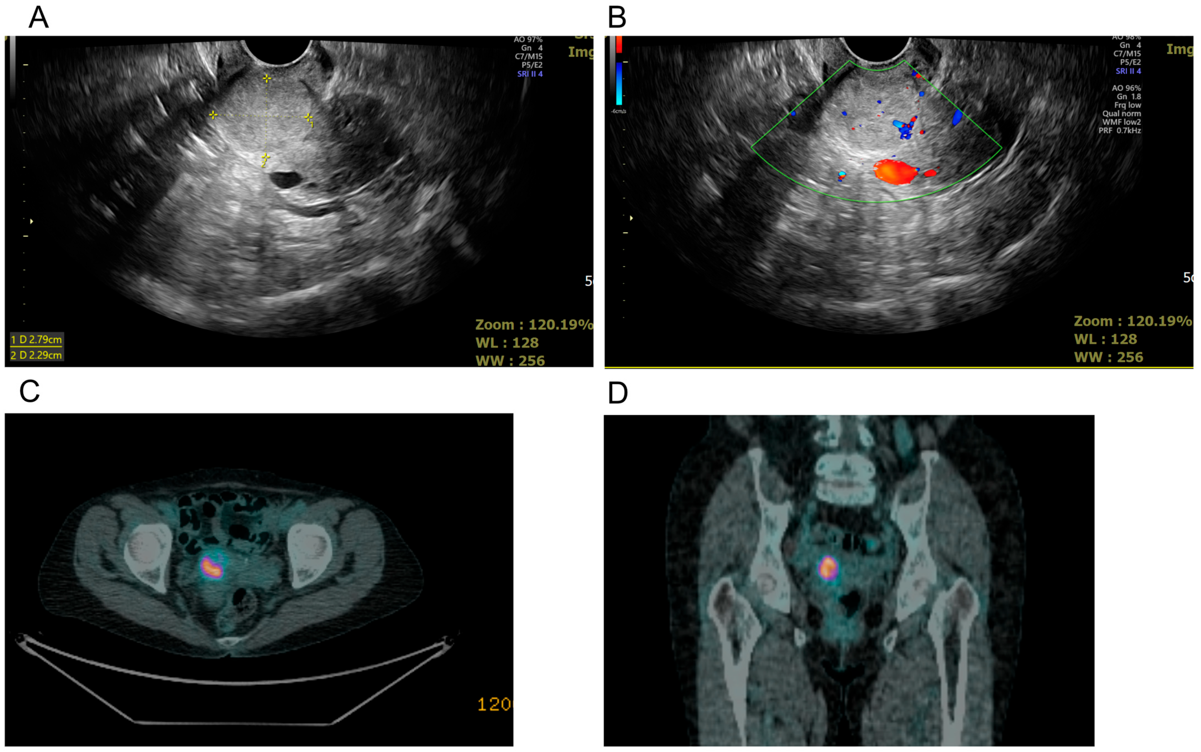 Diagnostics 15 00775 g001