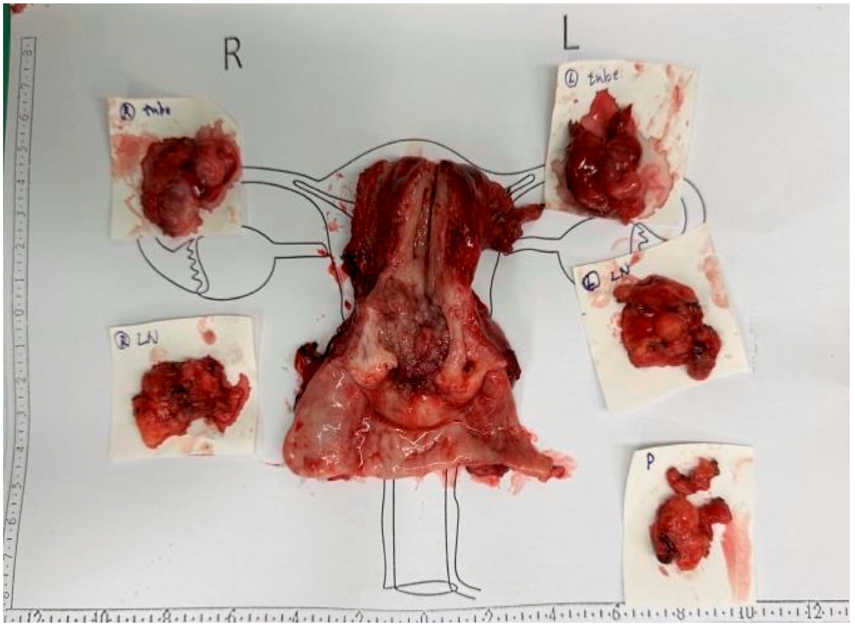 Diagnostics 15 00775 g002