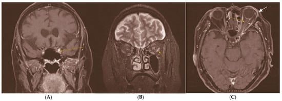 Diagnostics 15 00780 g001