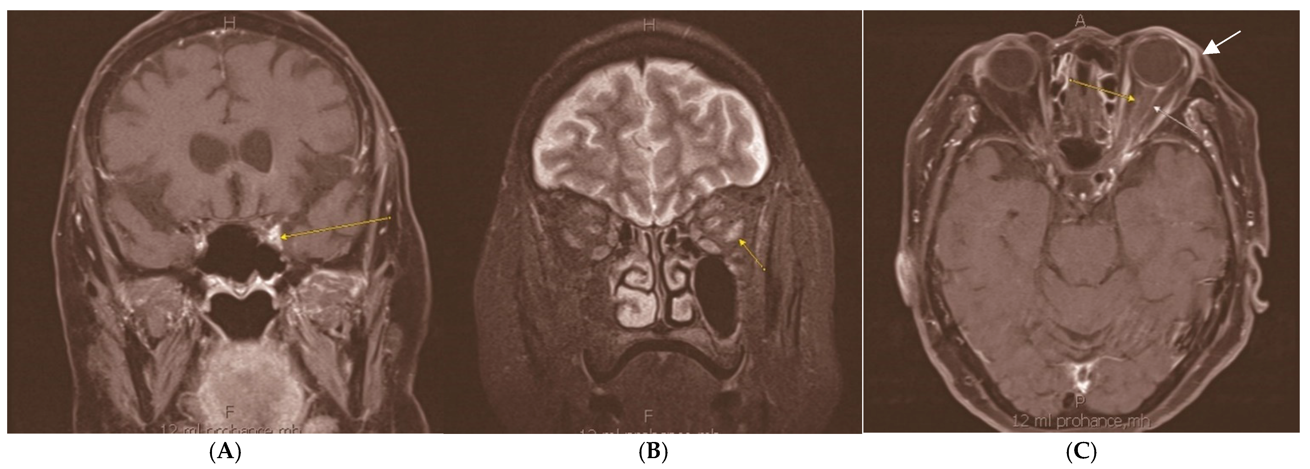 Diagnostics 15 00780 g001