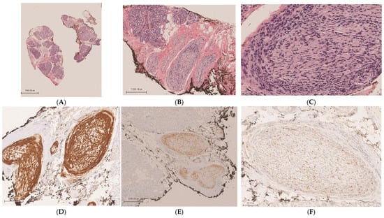 Diagnostics 15 00780 g002a