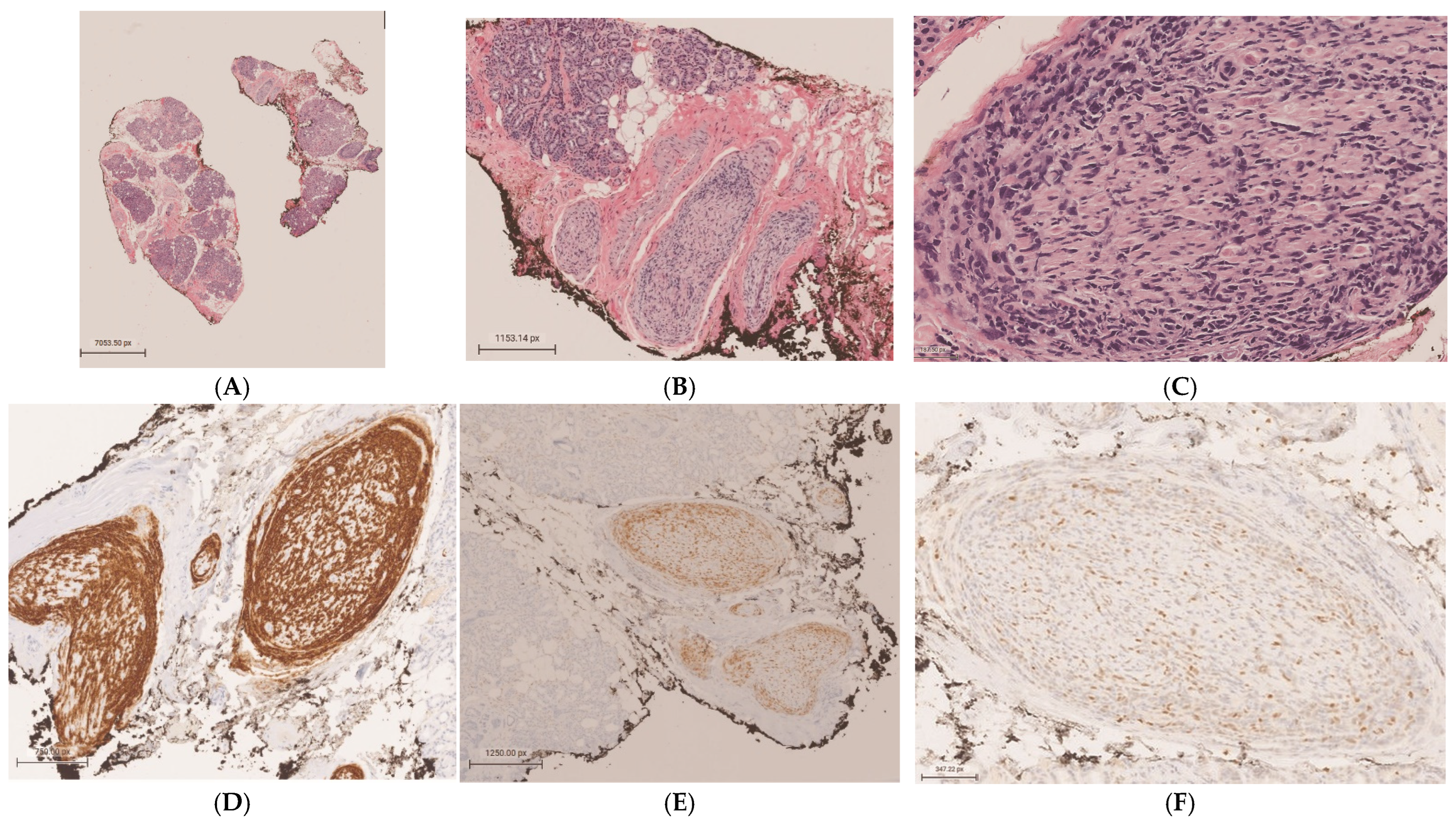Diagnostics 15 00780 g002a