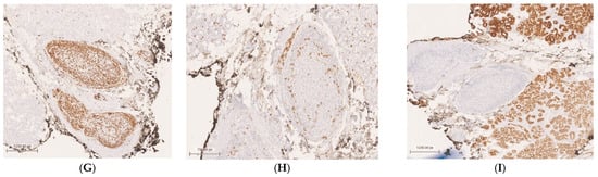 Diagnostics 15 00780 g002b