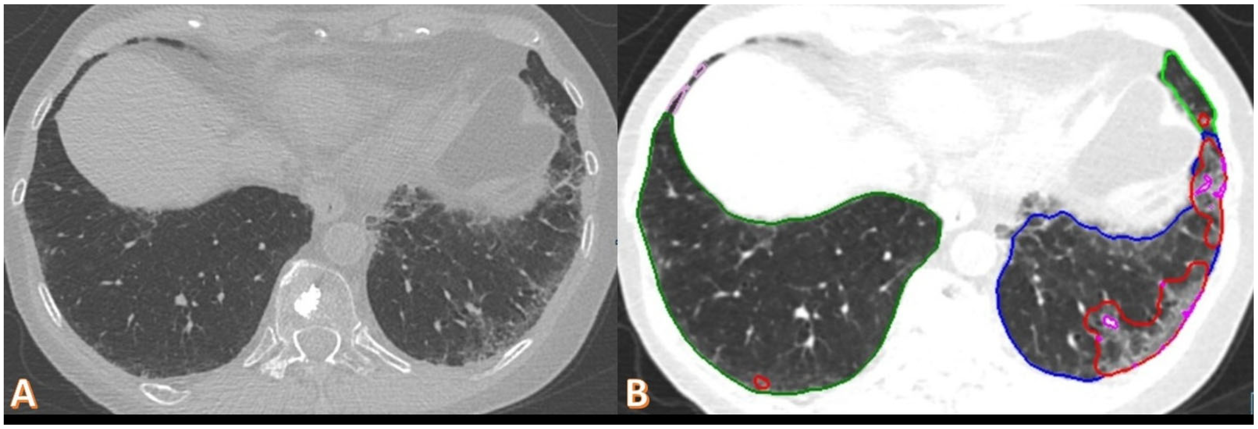 Diagnostics 15 00783 g005