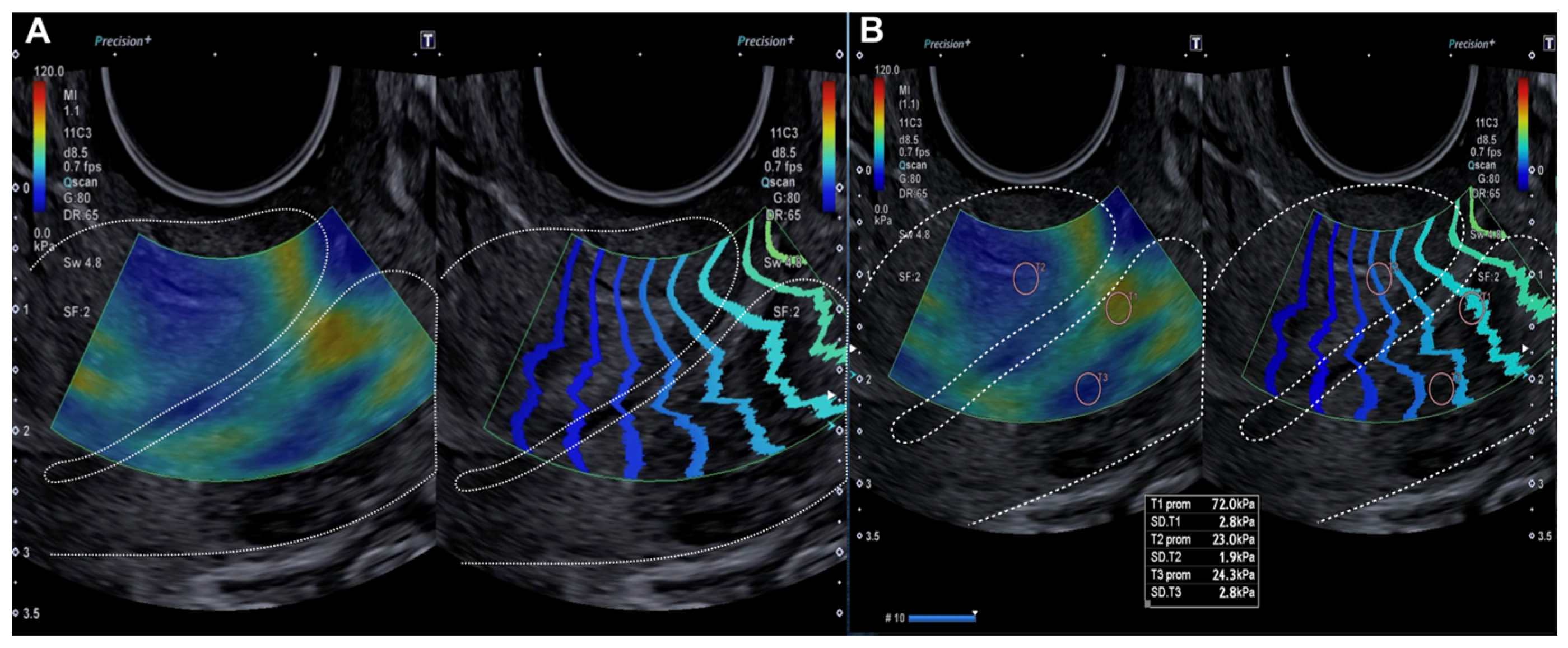 Diagnostics 15 00806 g001