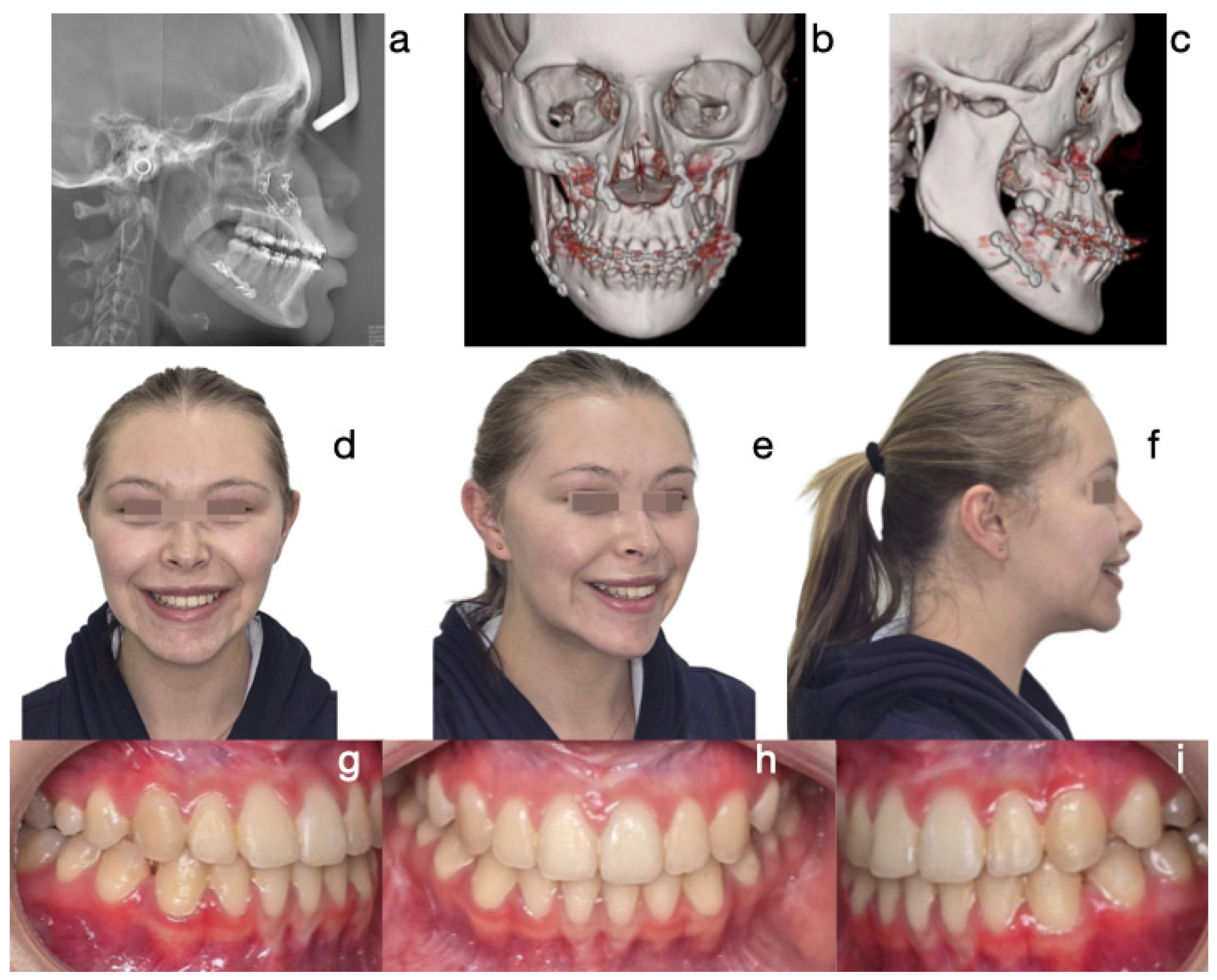 Diagnostics 15 00809 g004